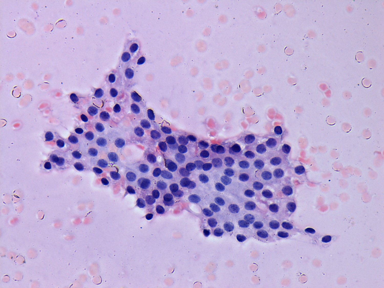 Right lobe, longitudinal scan