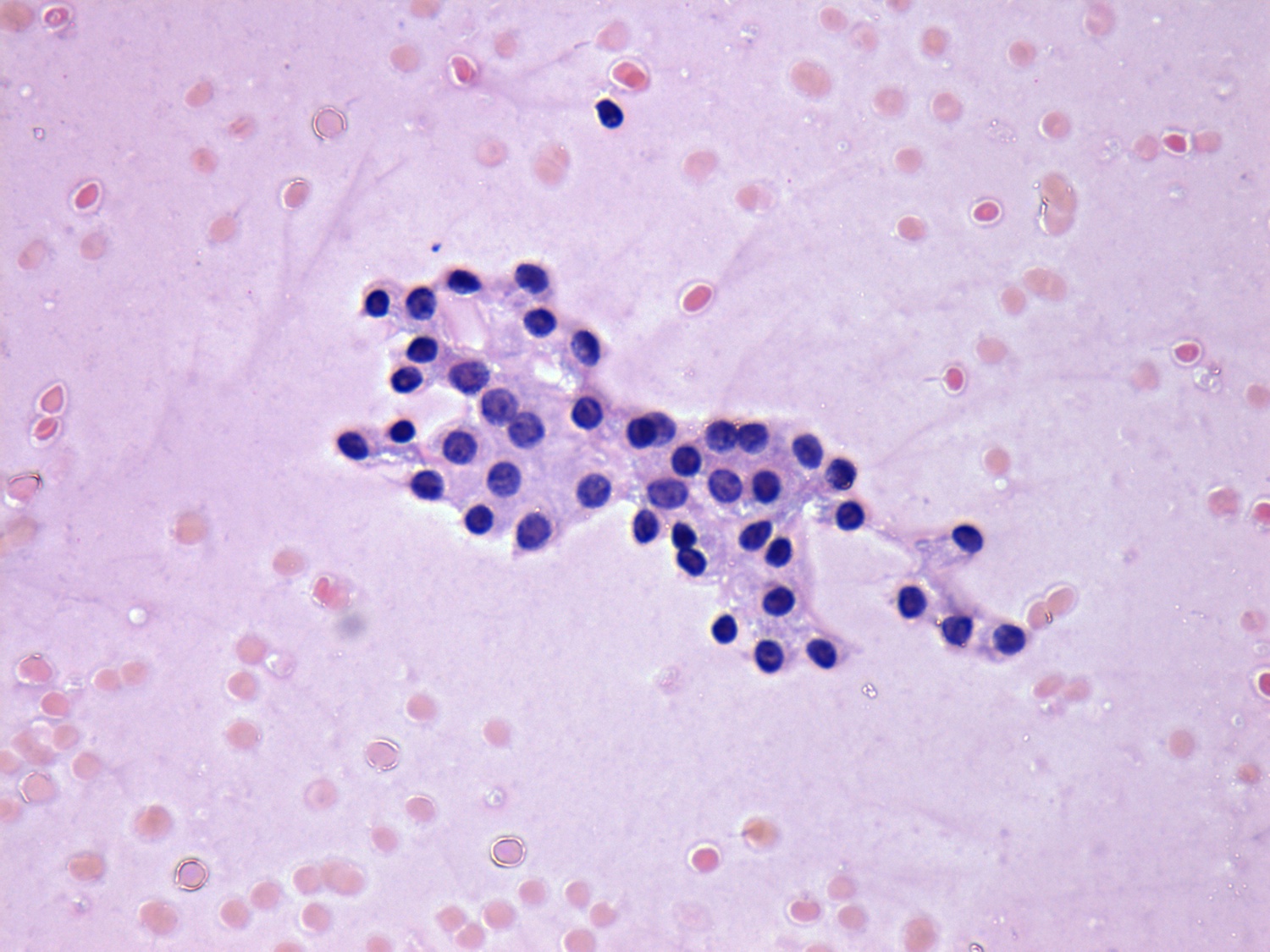 Right lobe, longitudinal scan