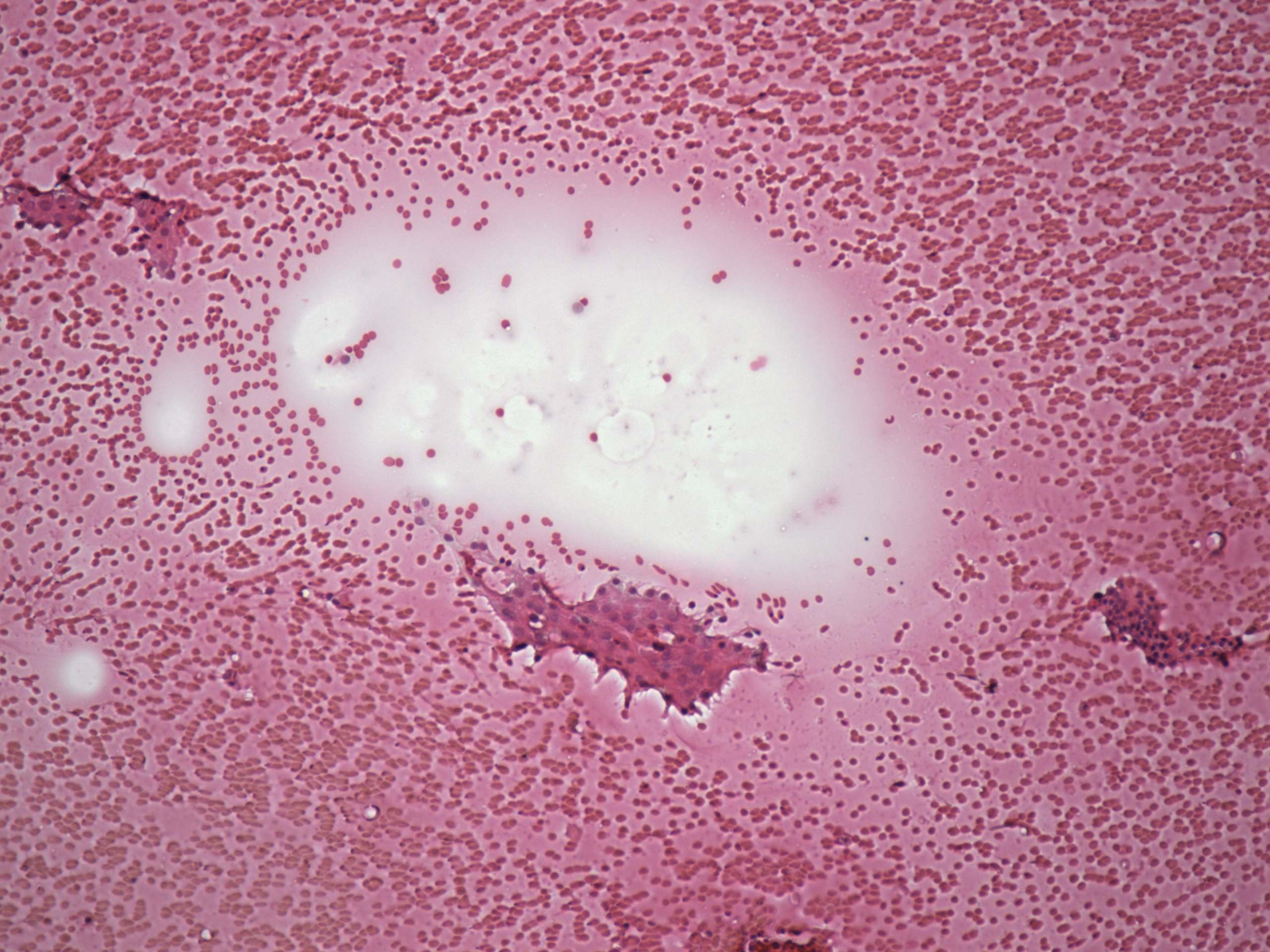 Right lobe, longitudinal scan