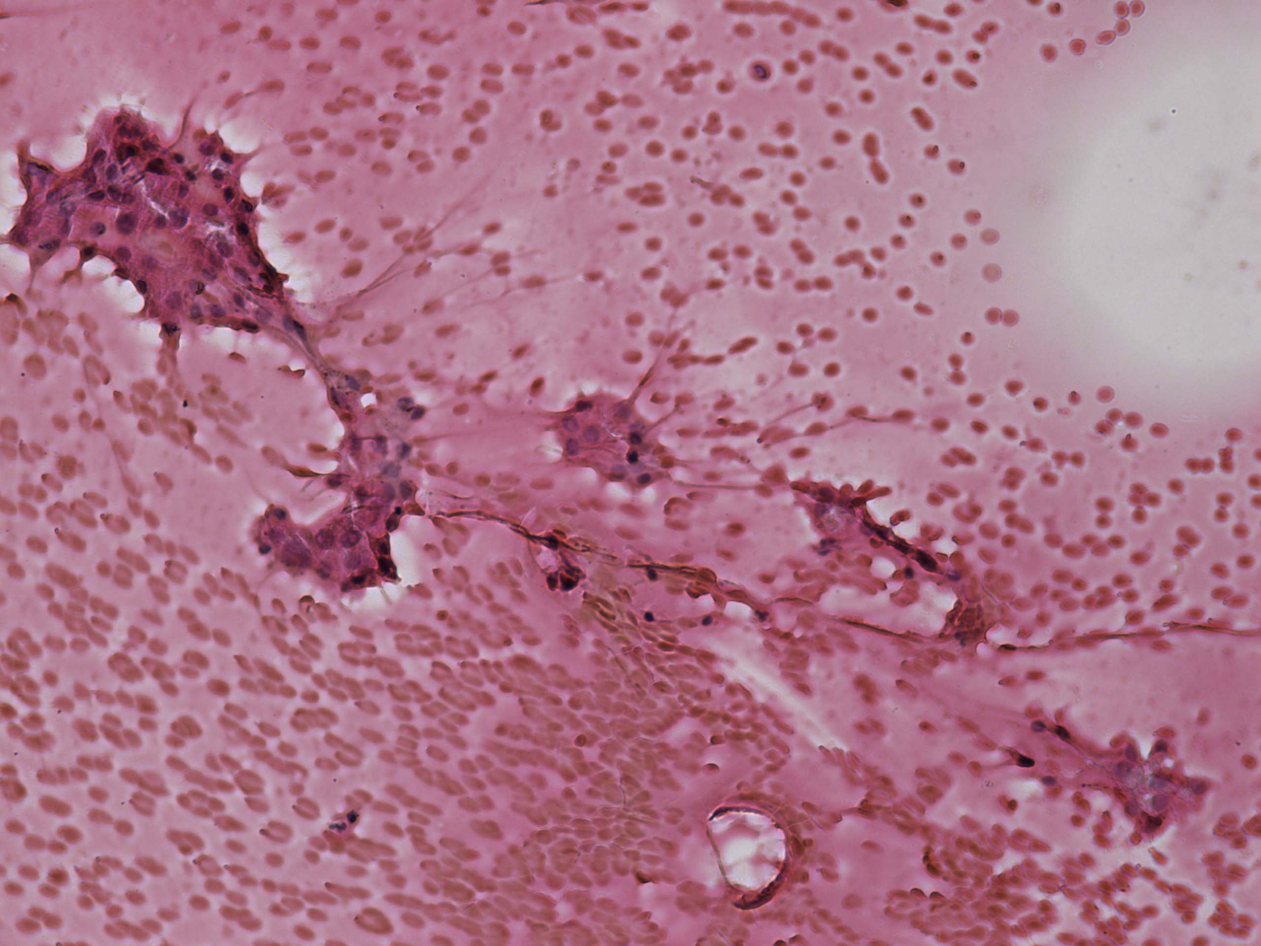 Right lobe, longitudinal scan