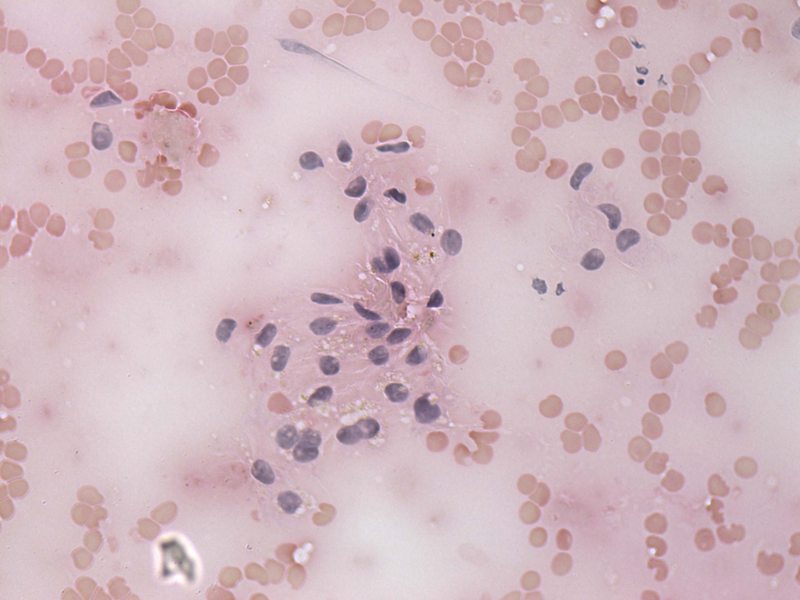 Right lobe, longitudinal scan