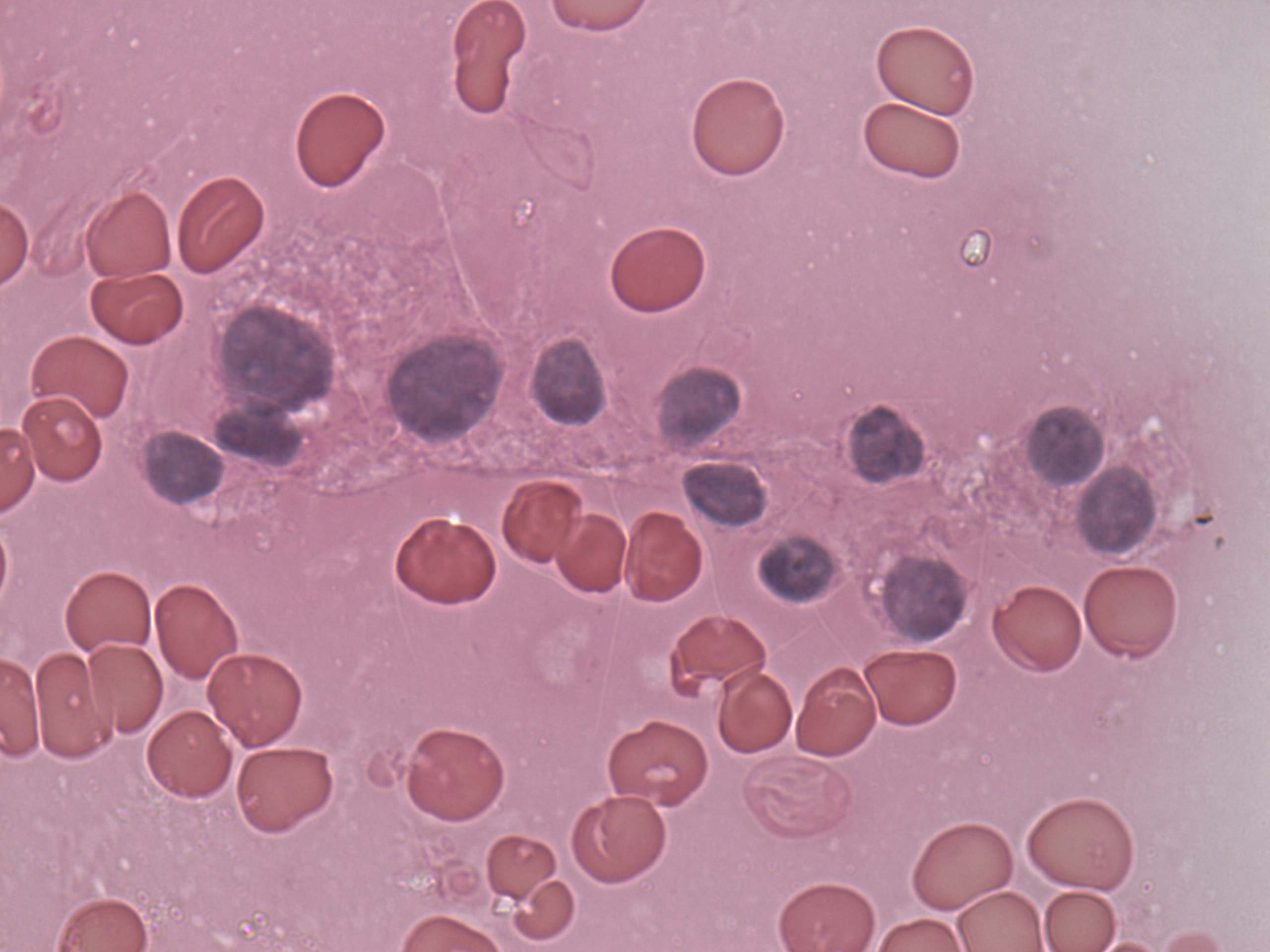 Right lobe, longitudinal scan