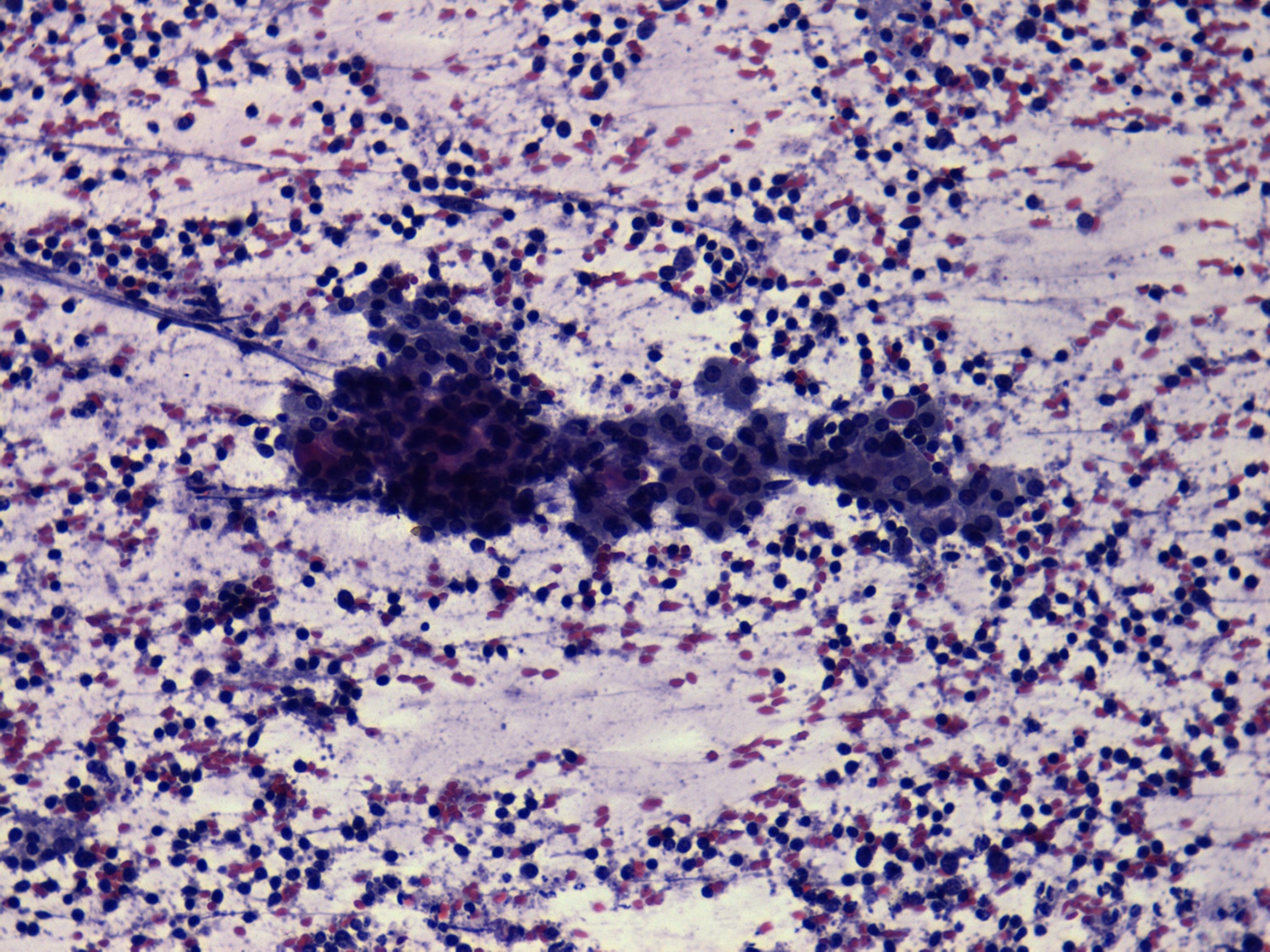 Right lobe, longitudinal scan