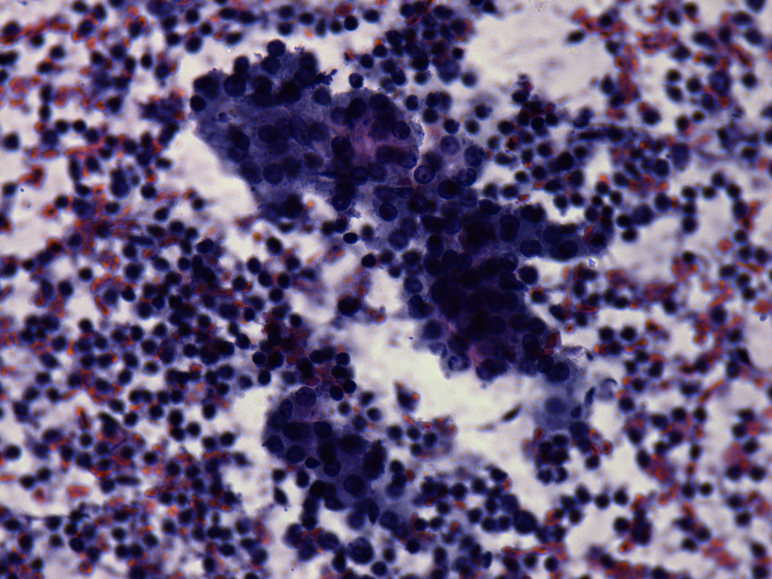 Right lobe, longitudinal scan