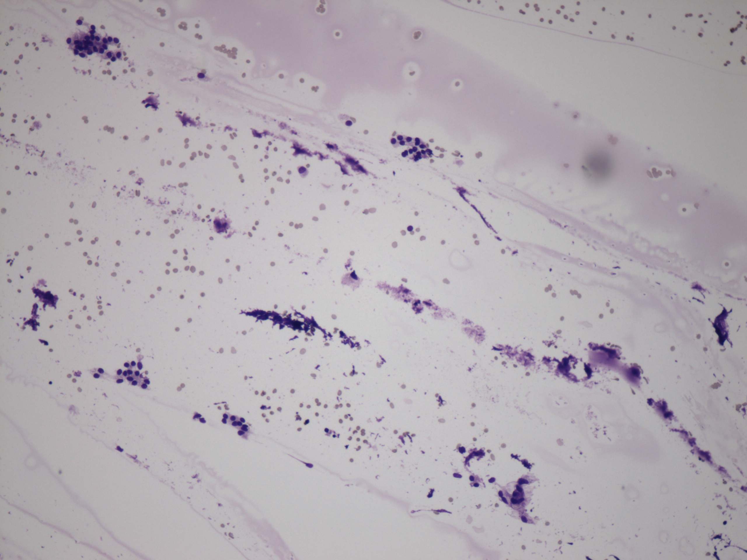 Right lobe, longitudinal scan