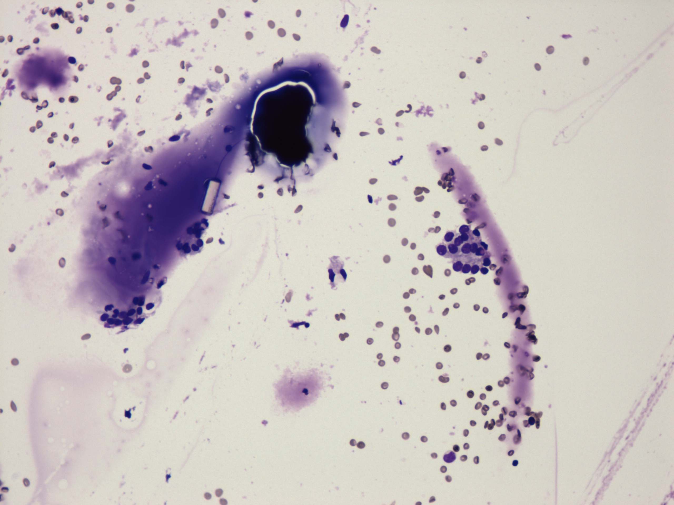 Right lobe, longitudinal scan
