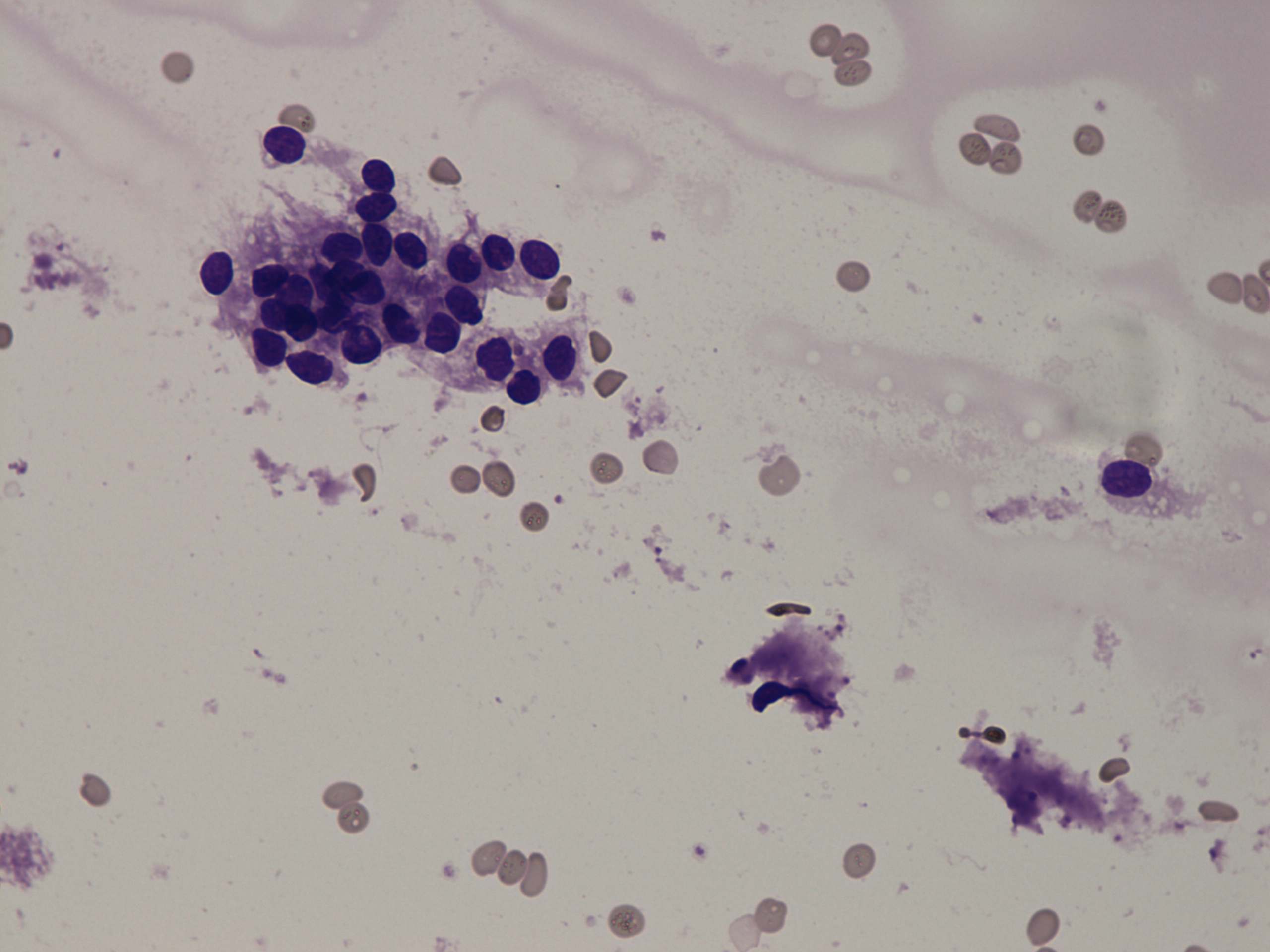 Right lobe, longitudinal scan