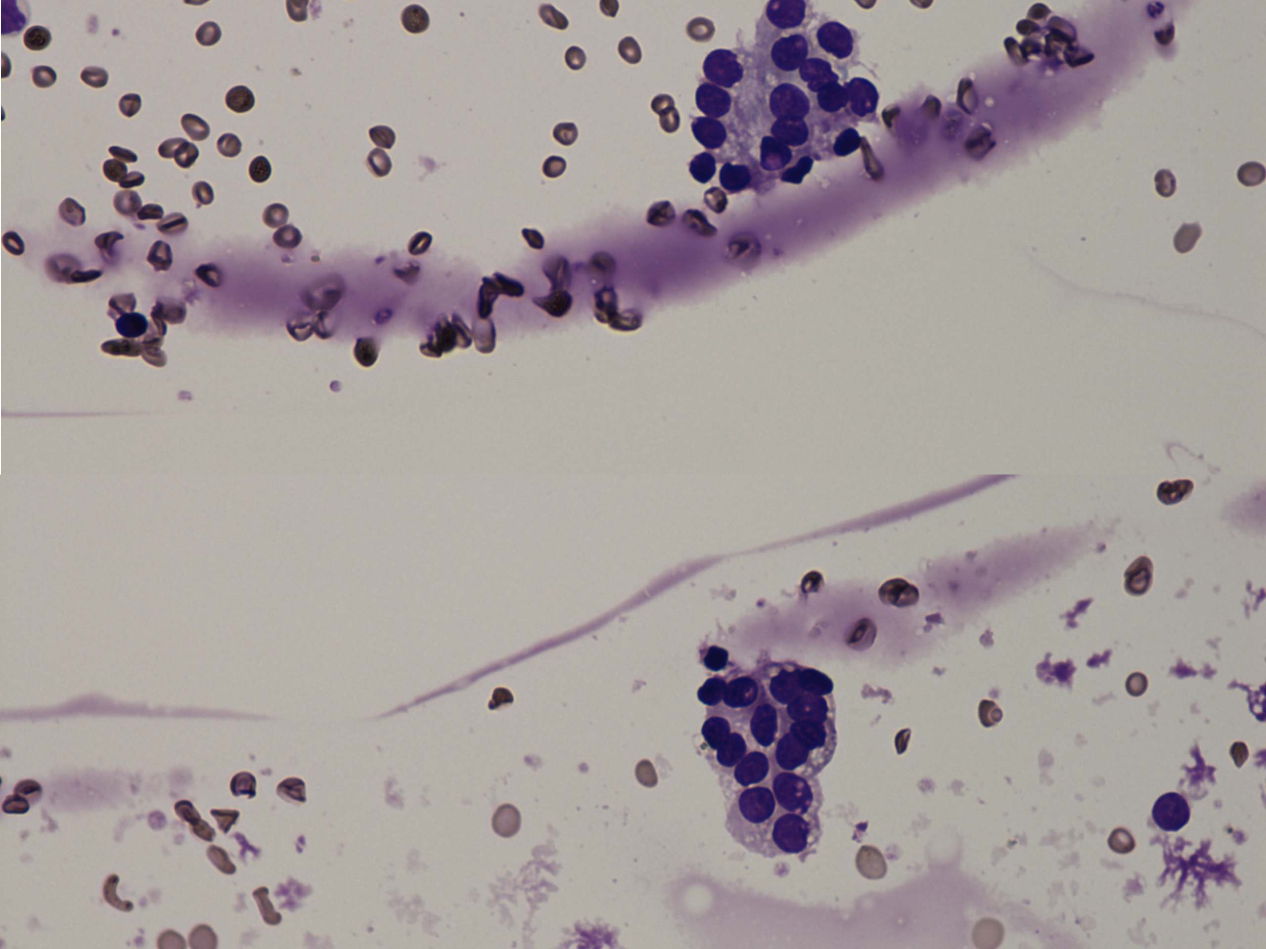 Right lobe, longitudinal scan