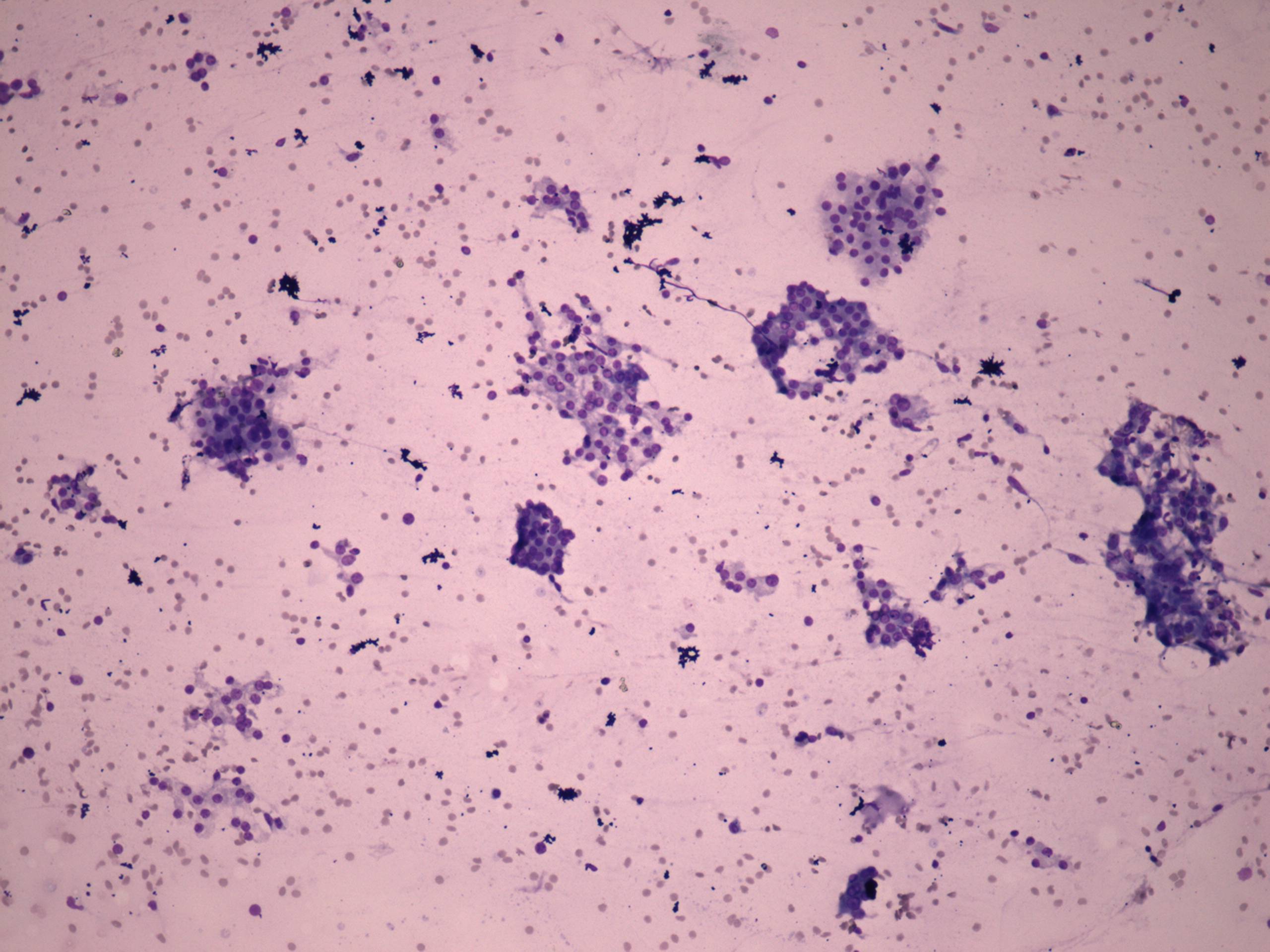 Right lobe, longitudinal scan