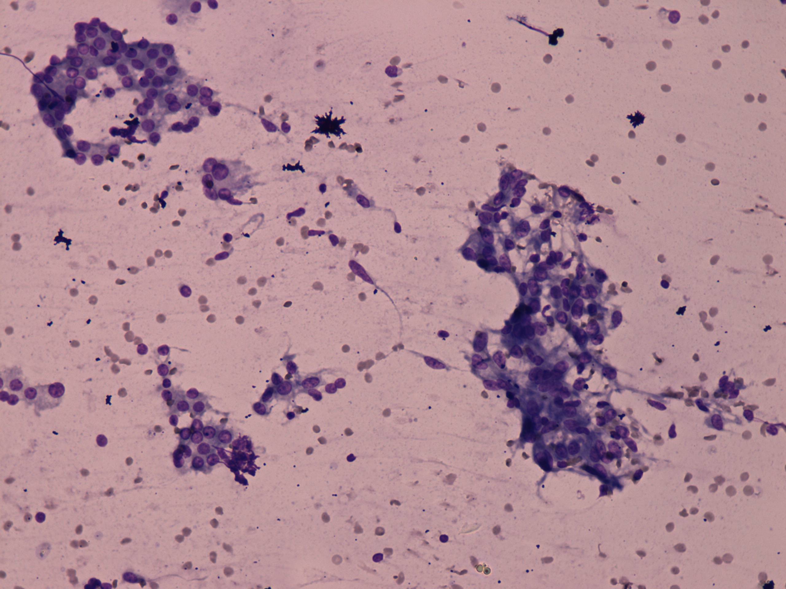 Right lobe, longitudinal scan