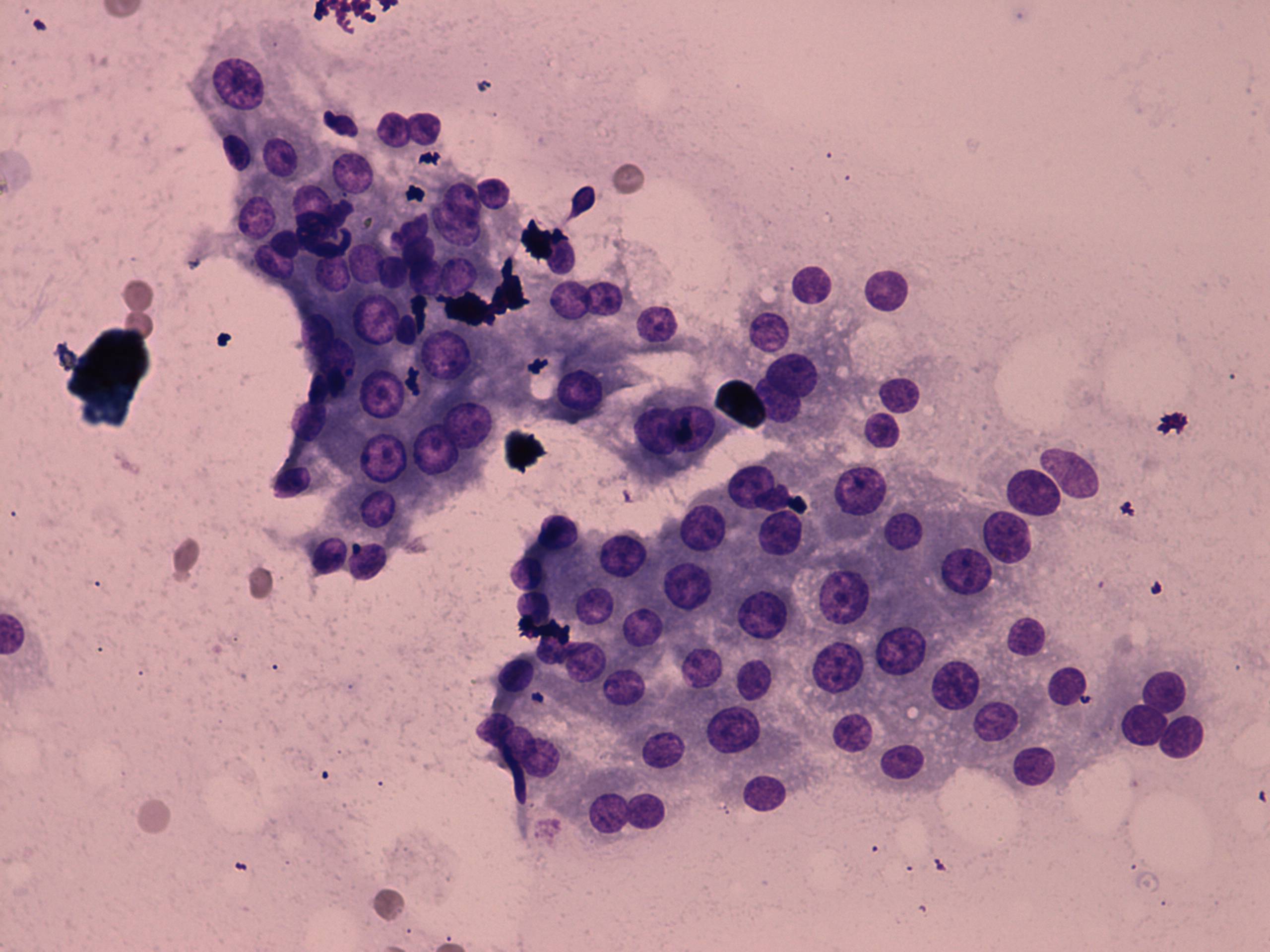 Right lobe, longitudinal scan