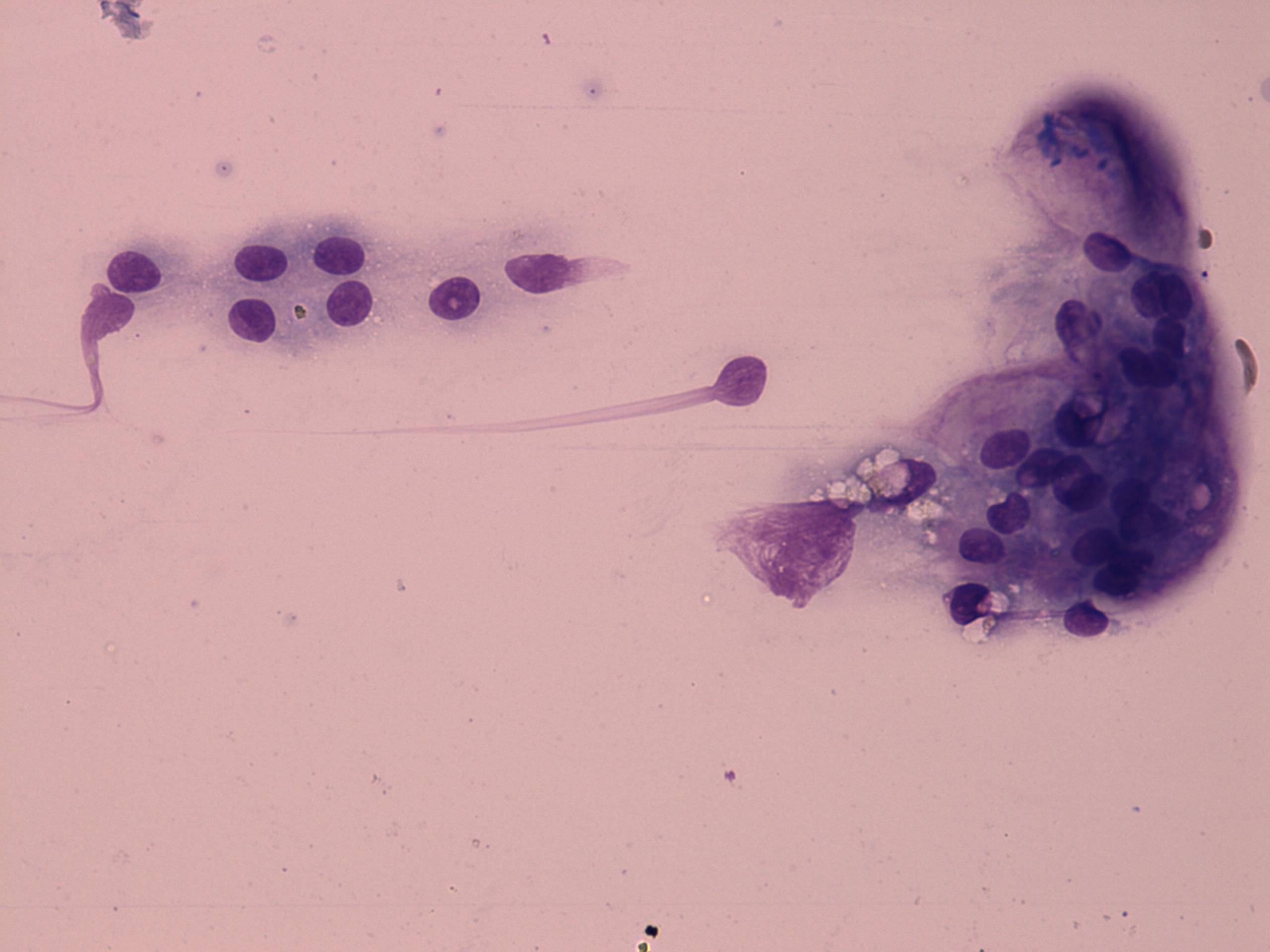 Right lobe, longitudinal scan