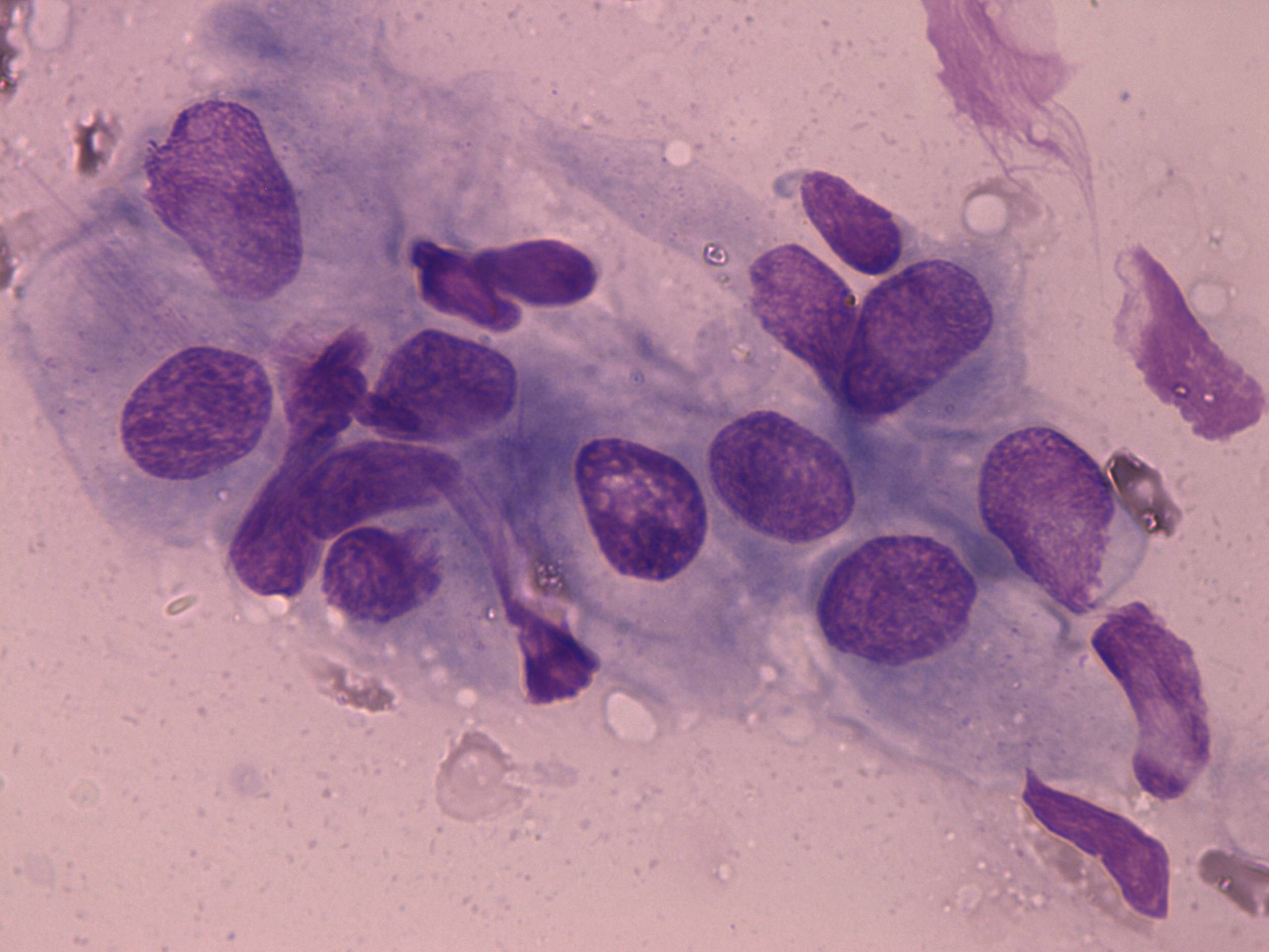 Right lobe, longitudinal scan