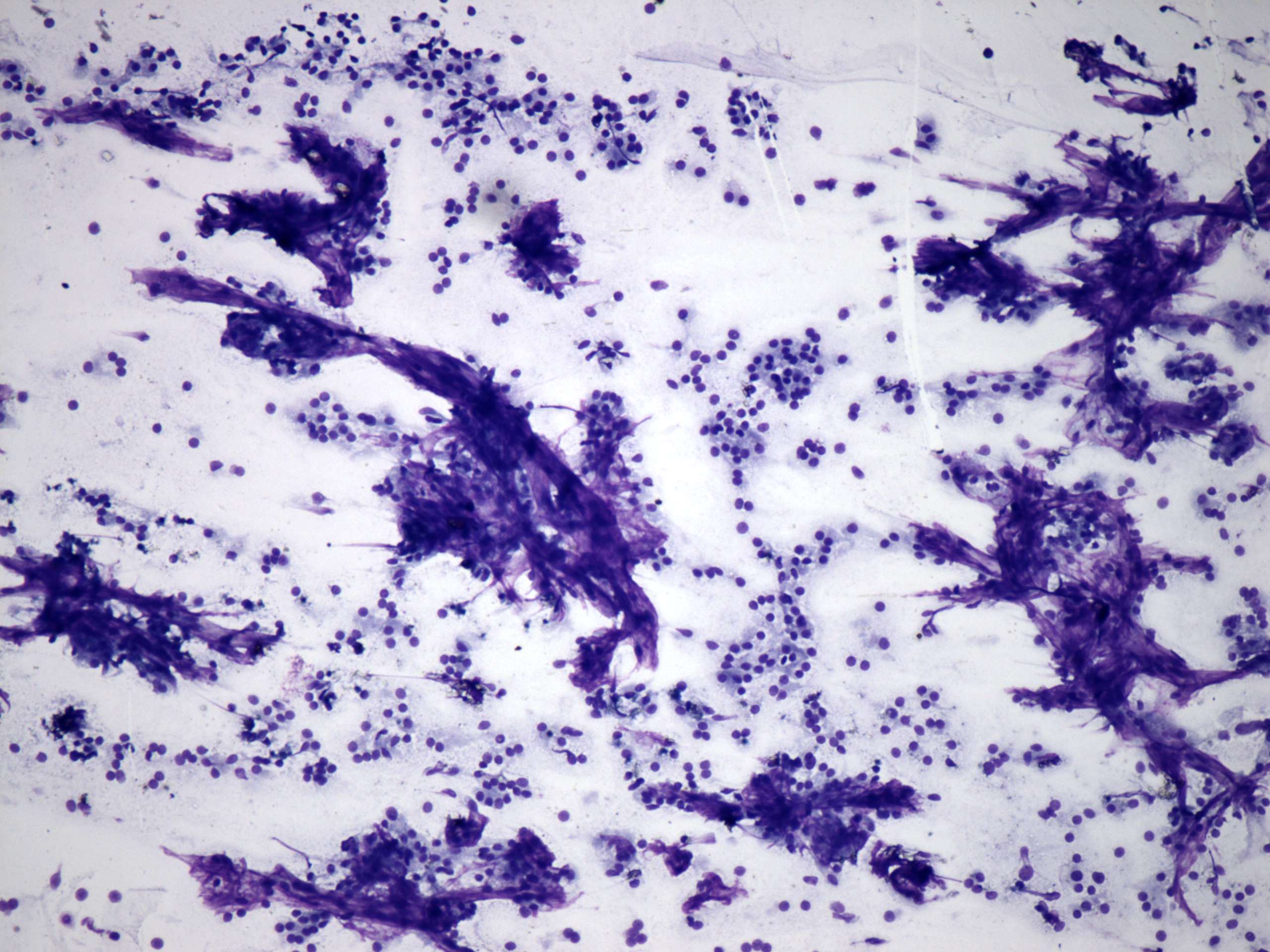 Right lobe, longitudinal scan