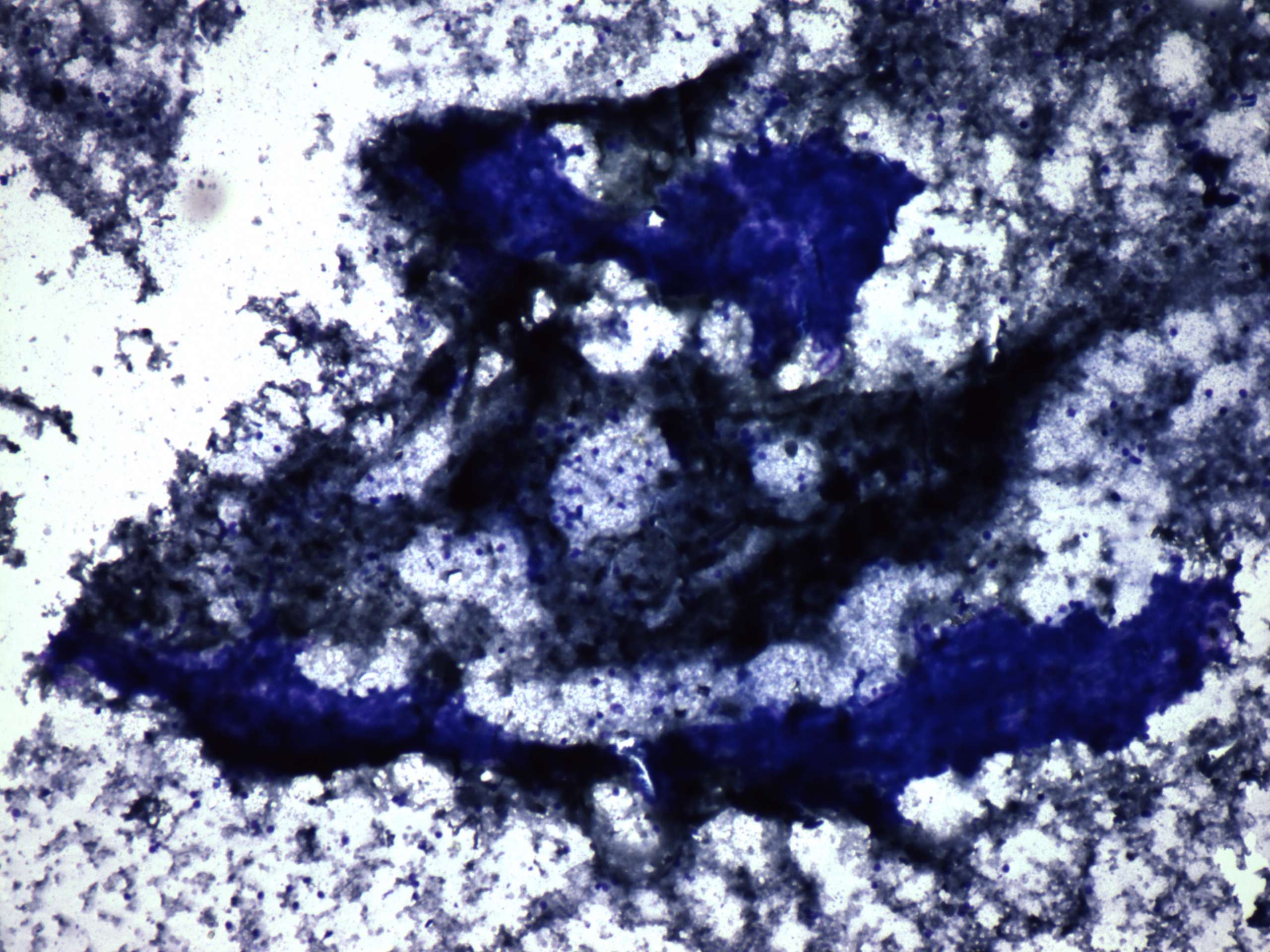 Right lobe, longitudinal scan