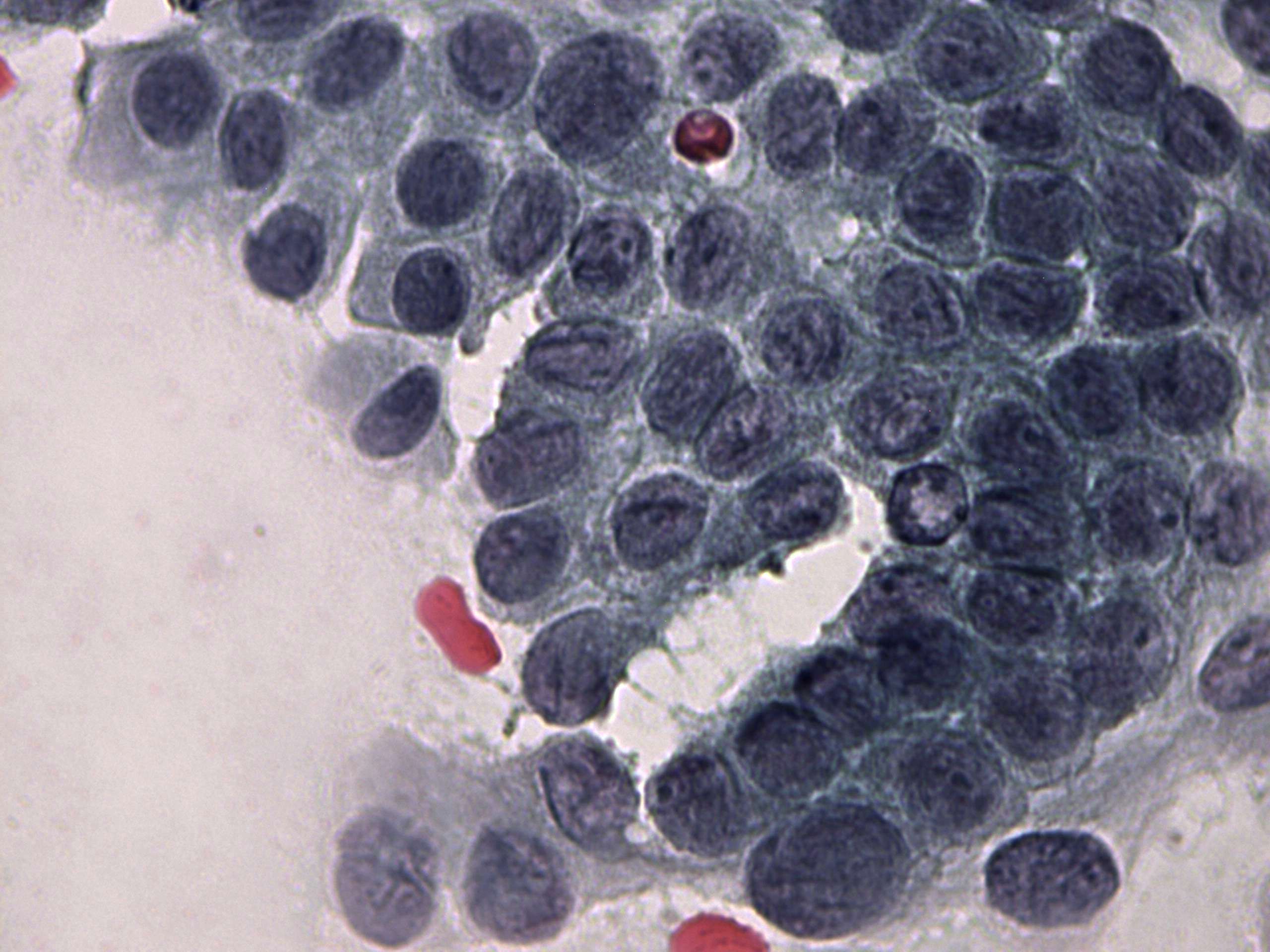 Right lobe, longitudinal scan