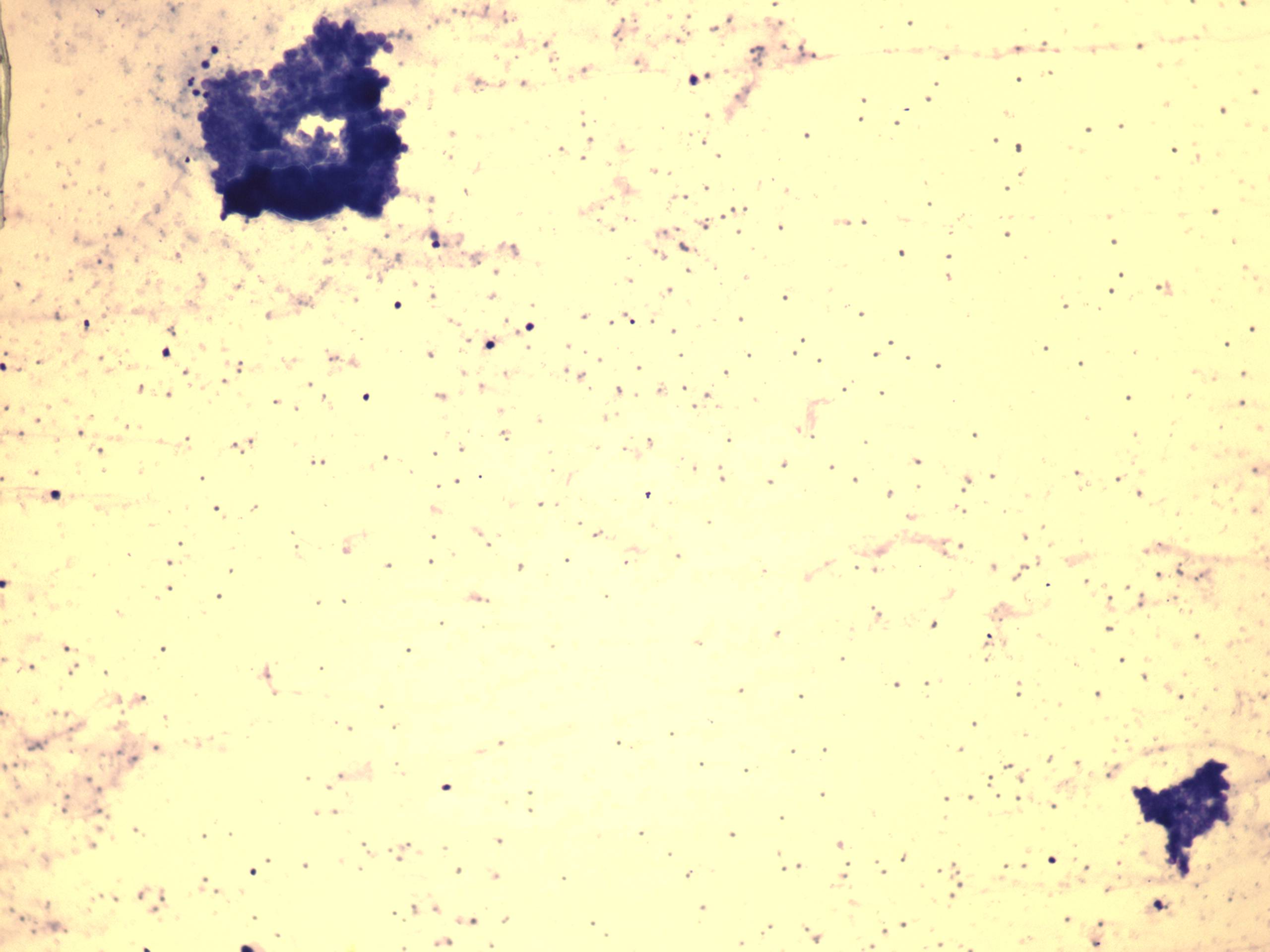 Right lobe, longitudinal scan