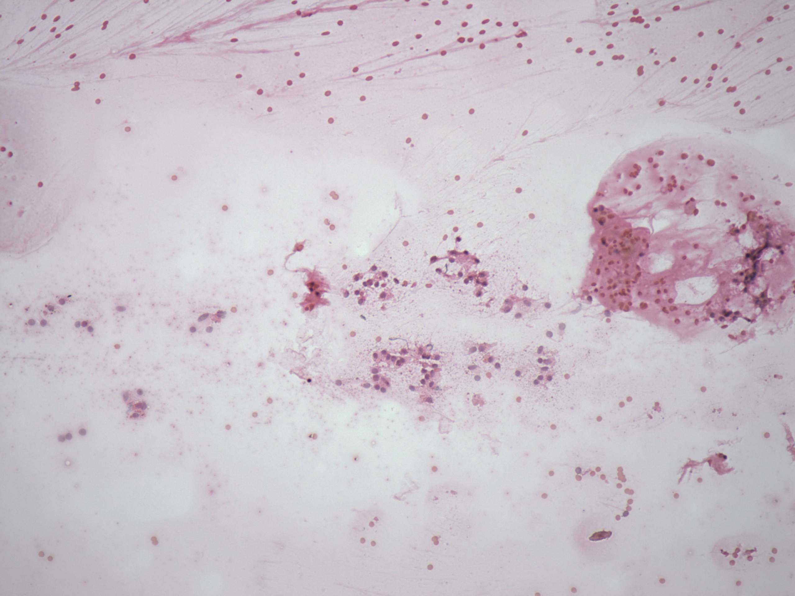 Right lobe, longitudinal scan