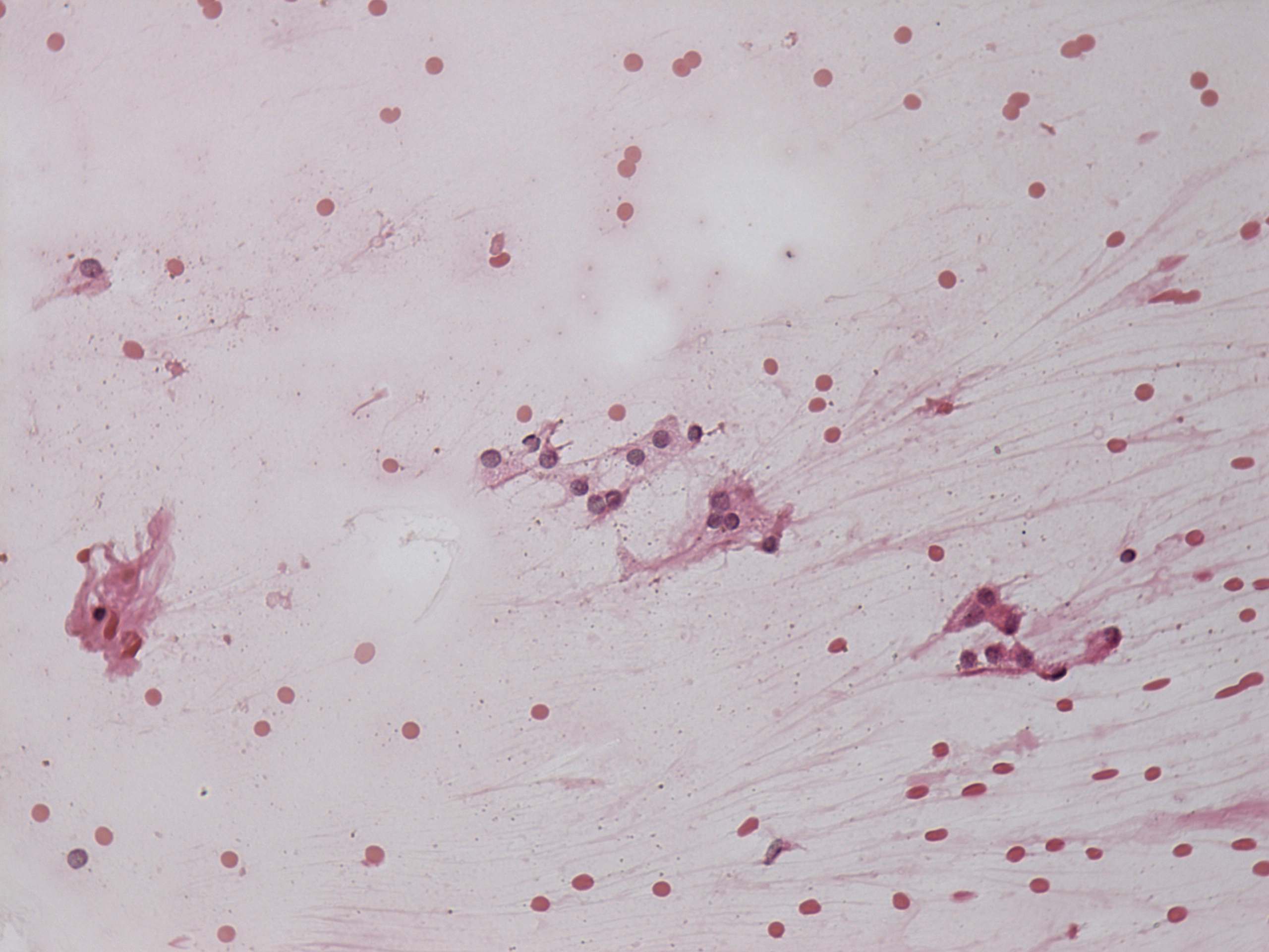 Right lobe, longitudinal scan