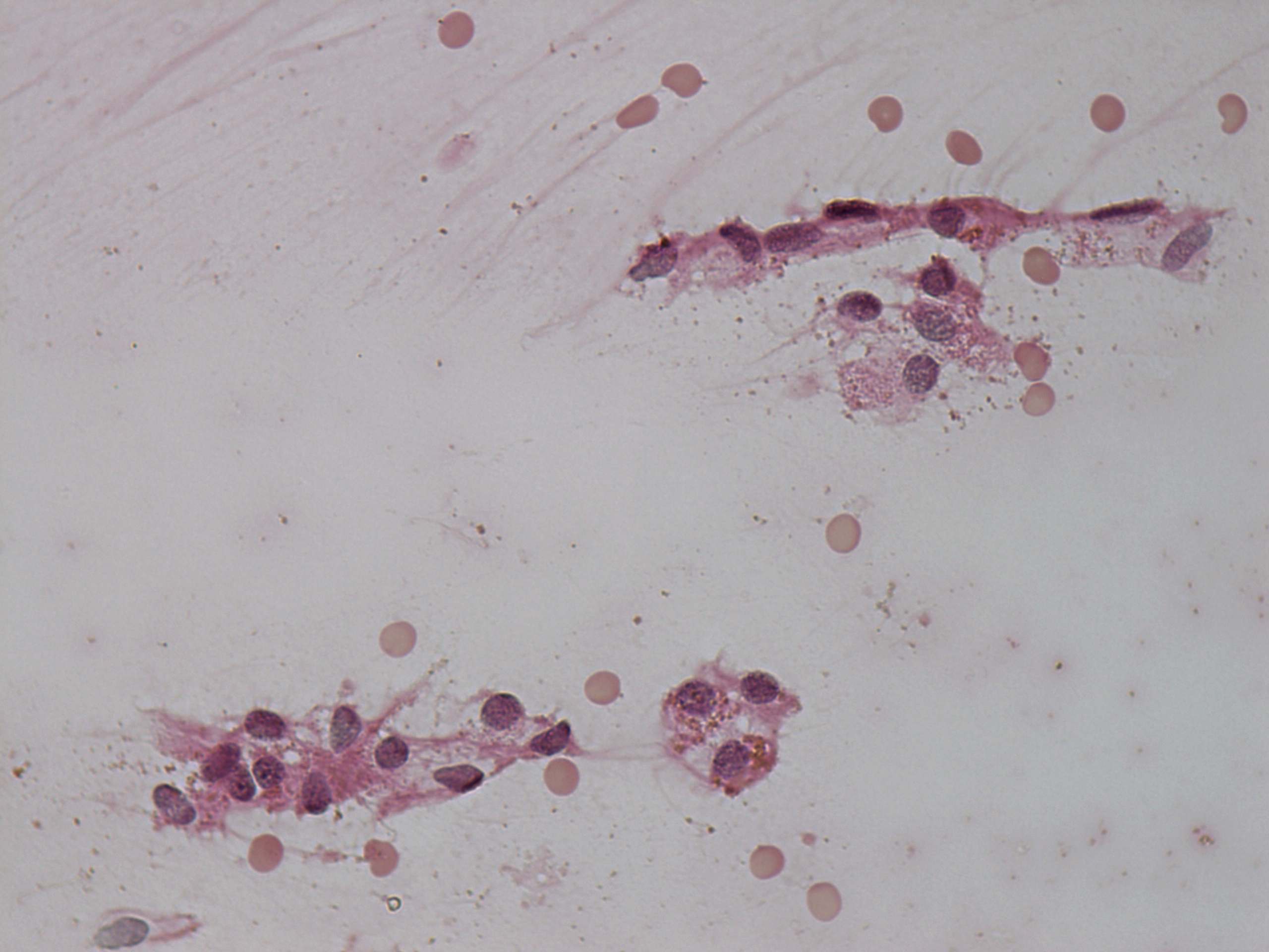 Right lobe, longitudinal scan