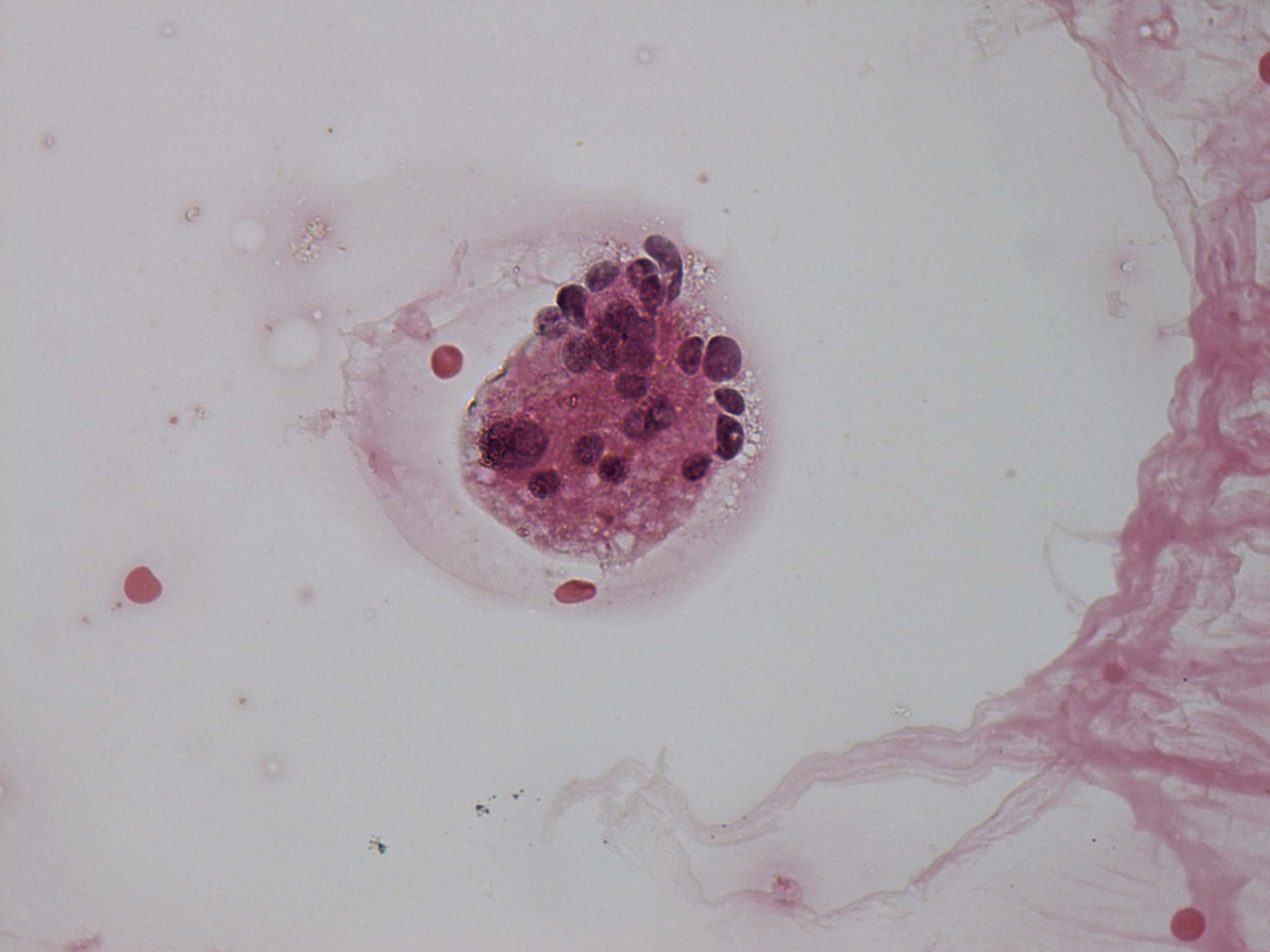 Right lobe, longitudinal scan