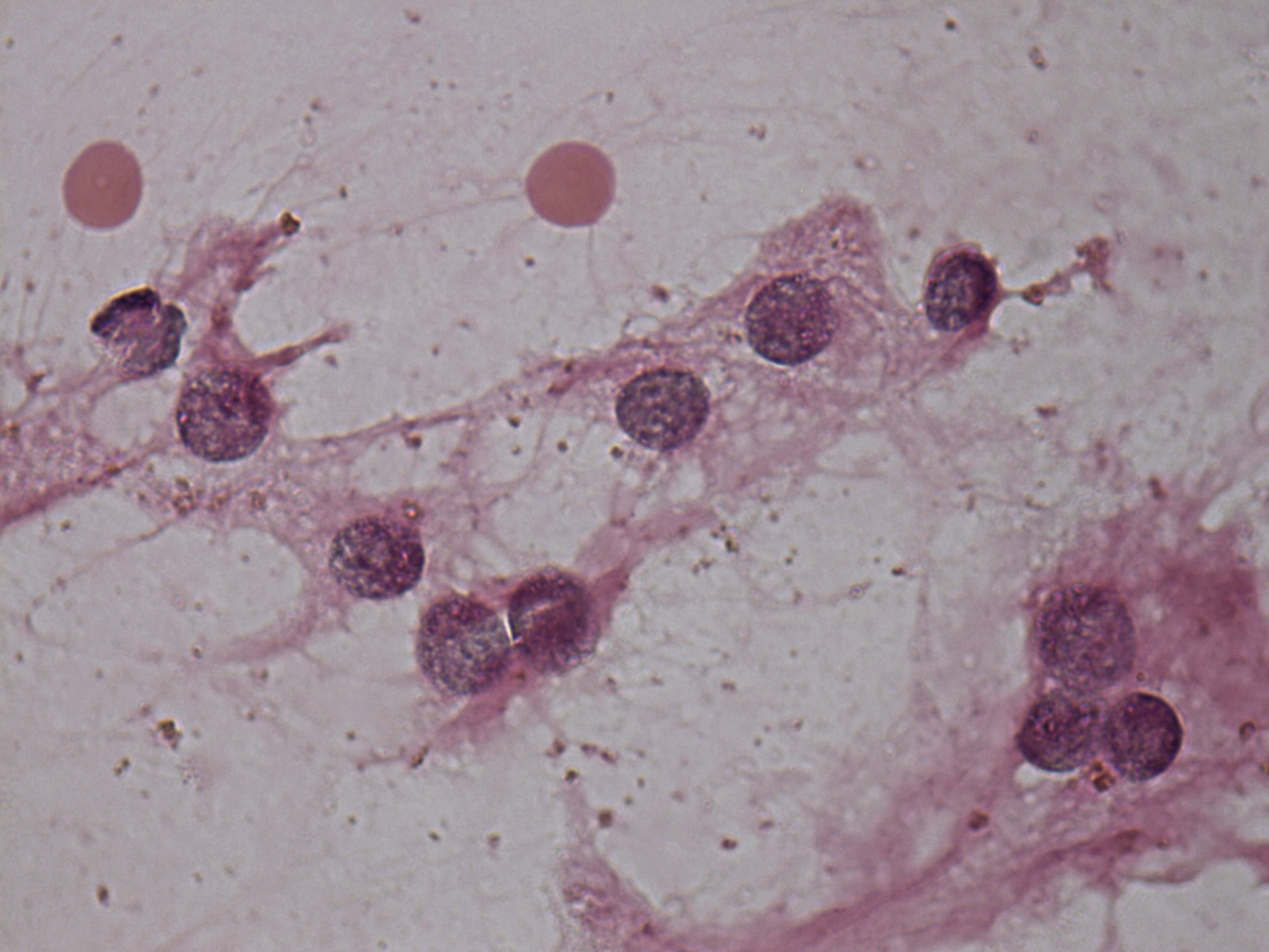 Right lobe, longitudinal scan
