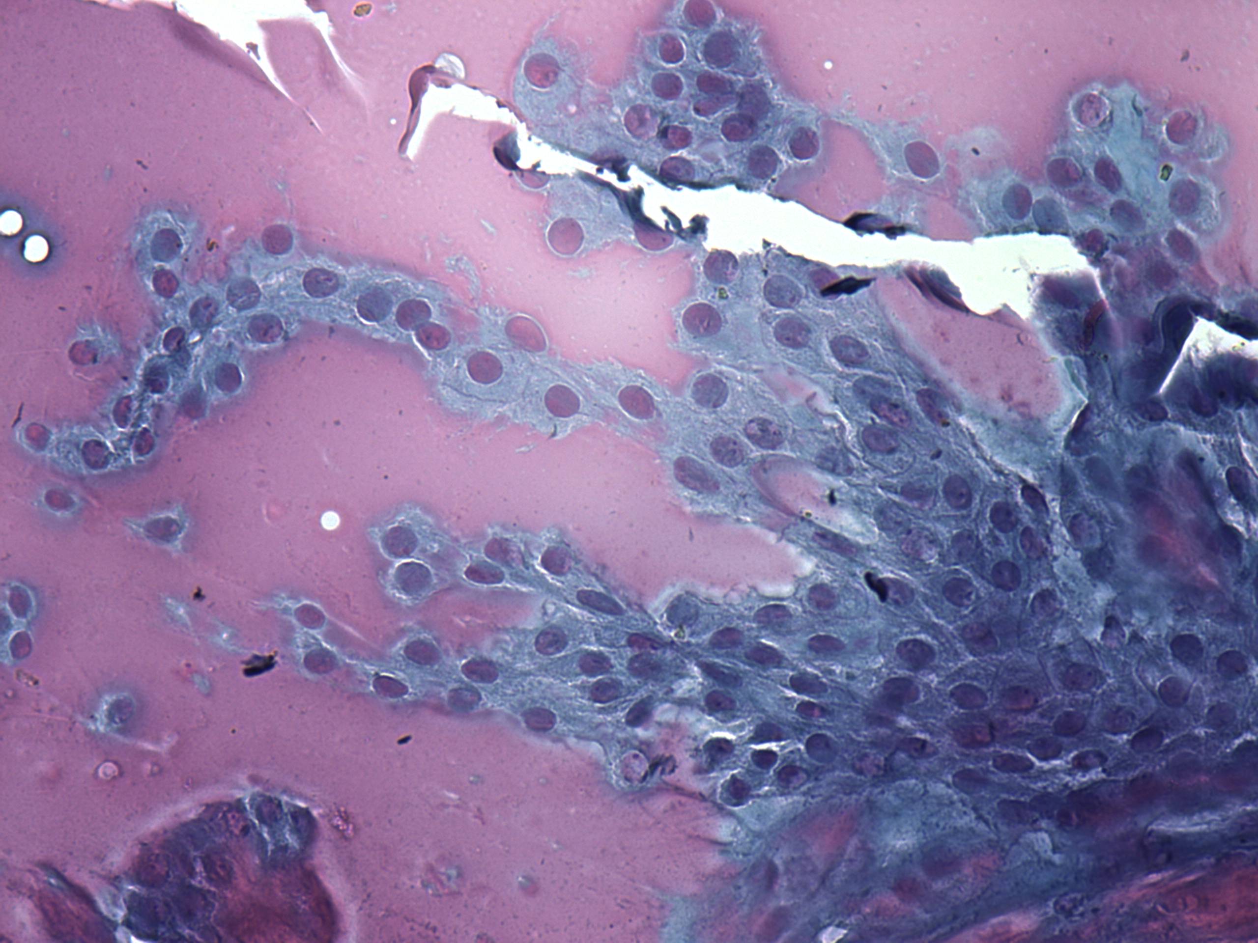 Right lobe, longitudinal scan