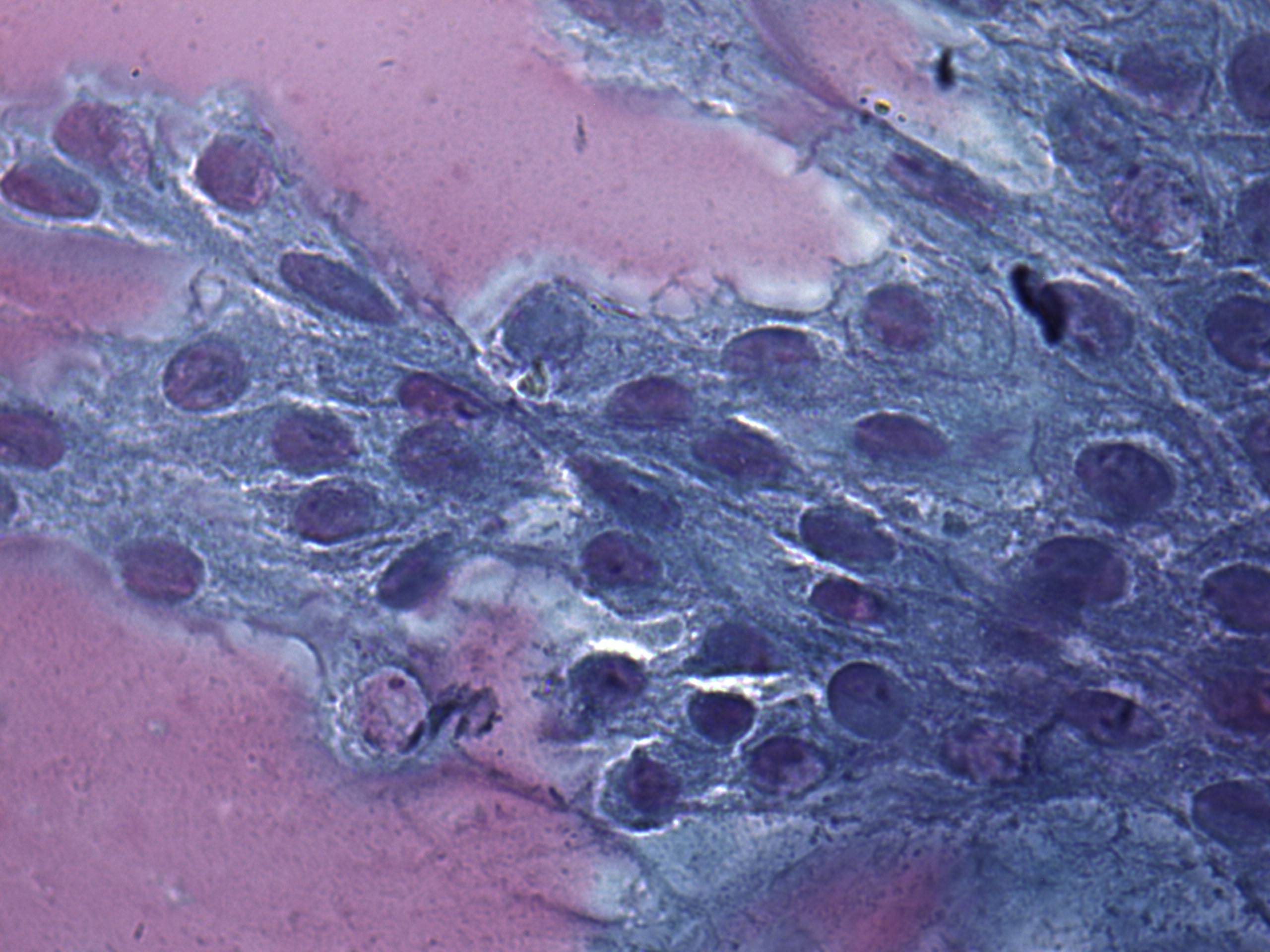 Right lobe, longitudinal scan