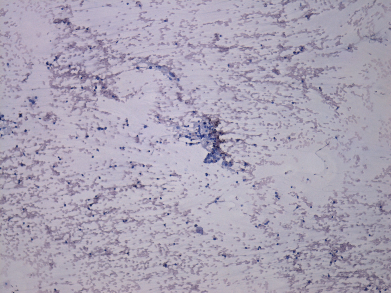 Right lobe, longitudinal scan