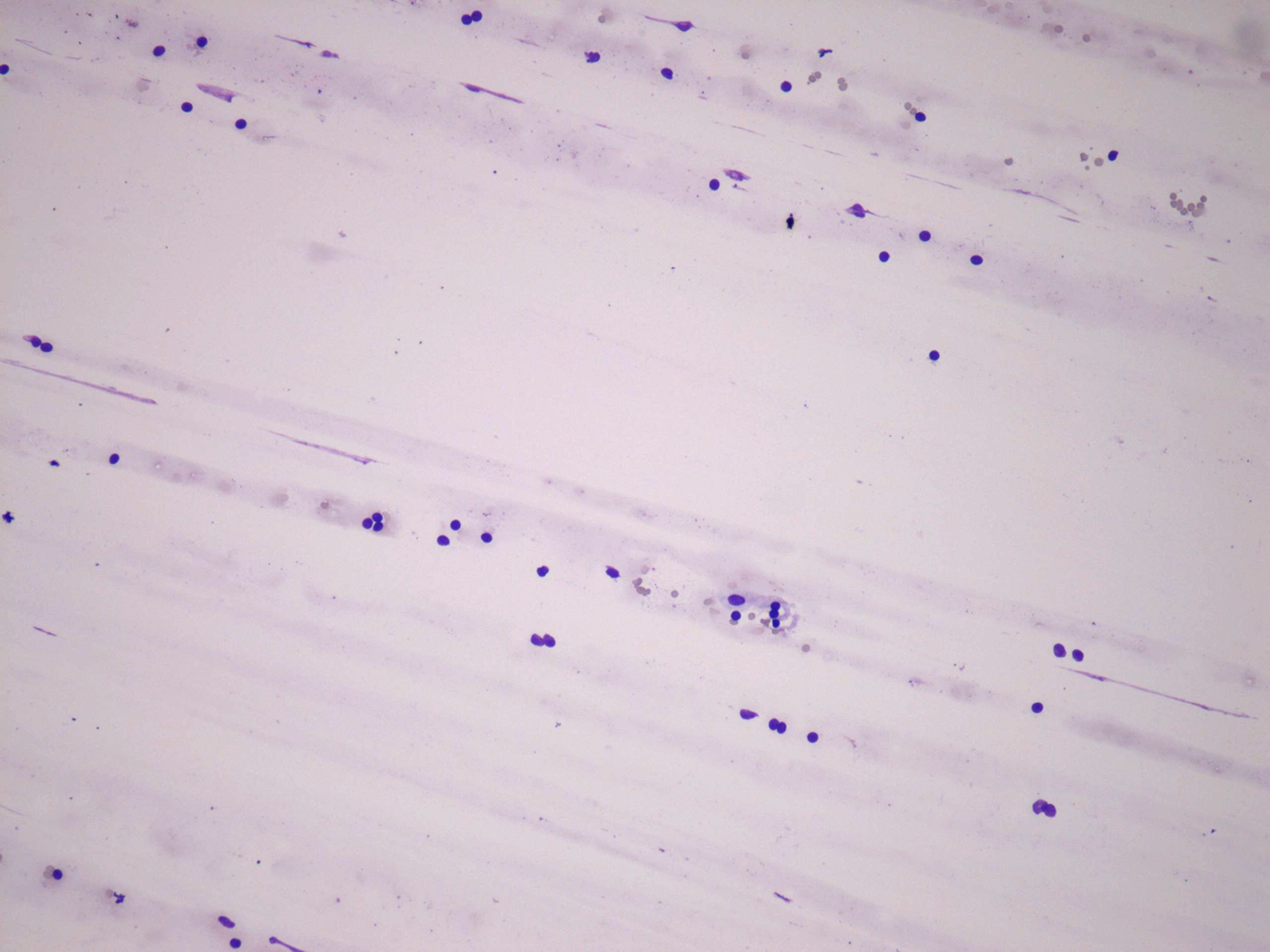 Right lobe, longitudinal scan