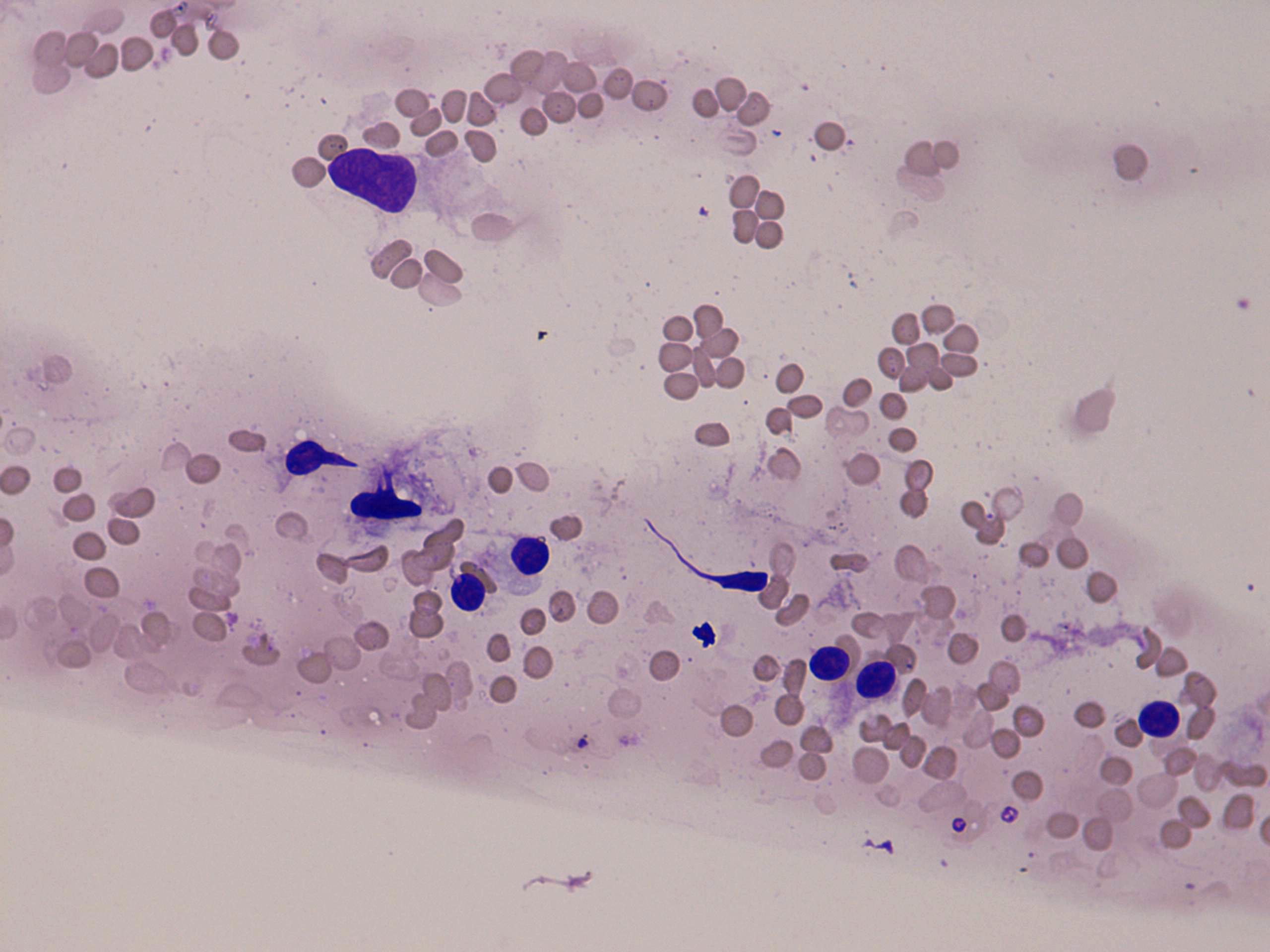 Right lobe, longitudinal scan
