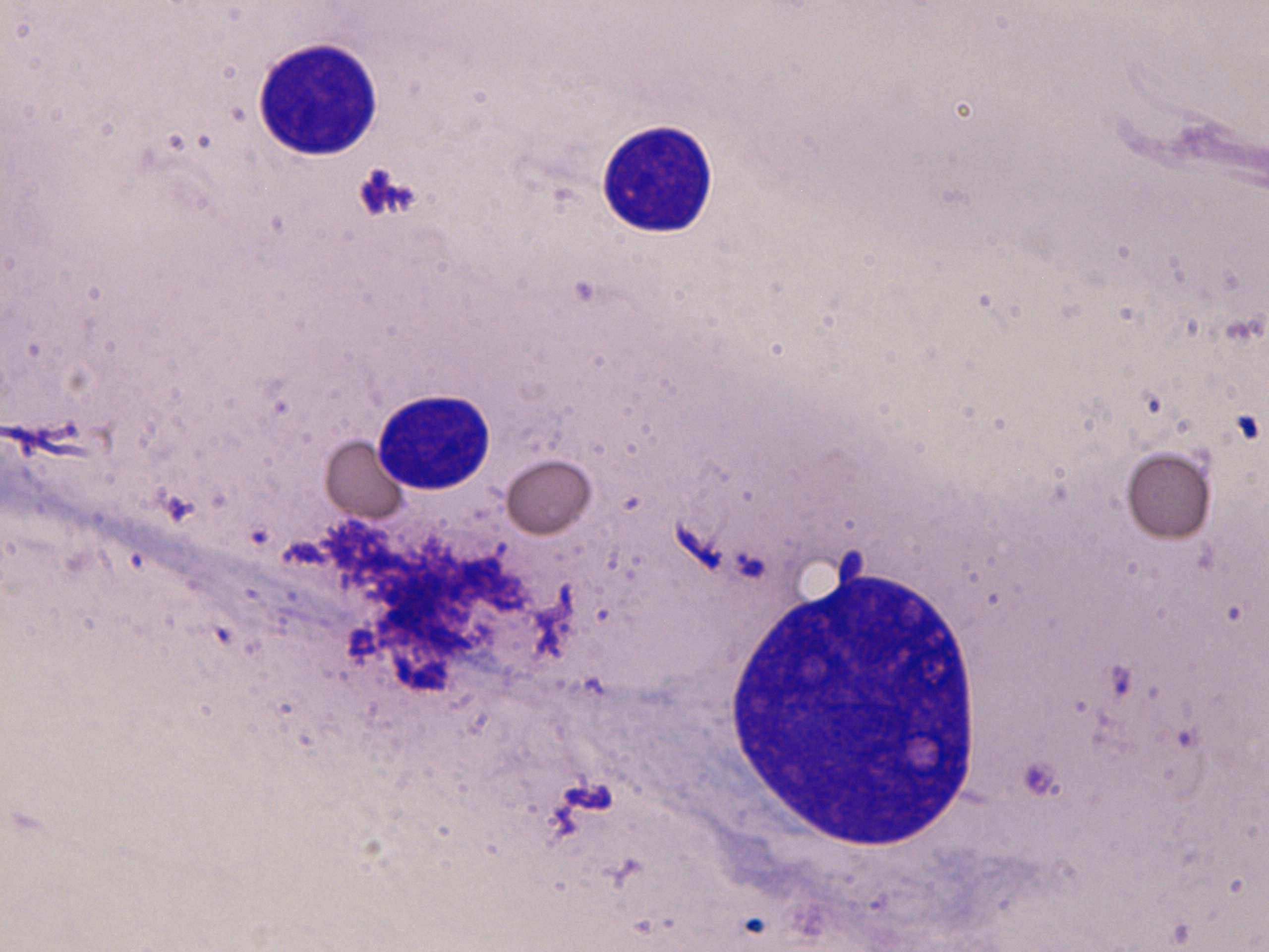 Right lobe, longitudinal scan