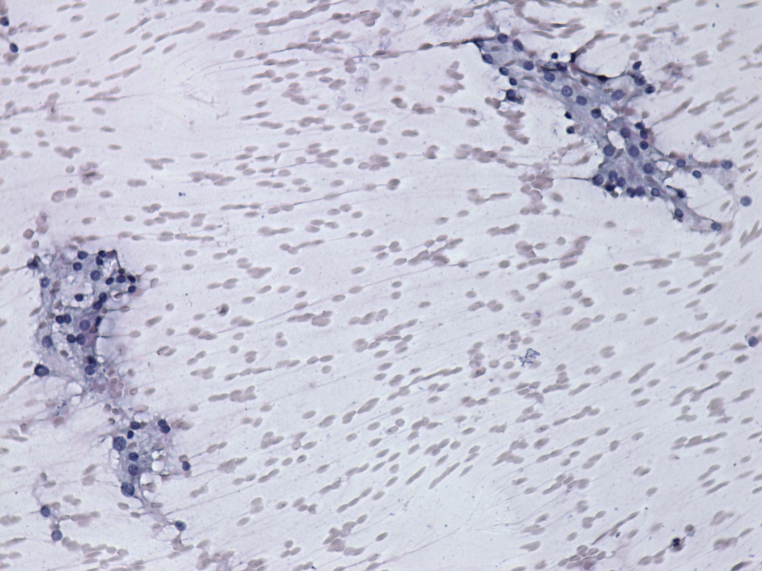 Right lobe, longitudinal scan