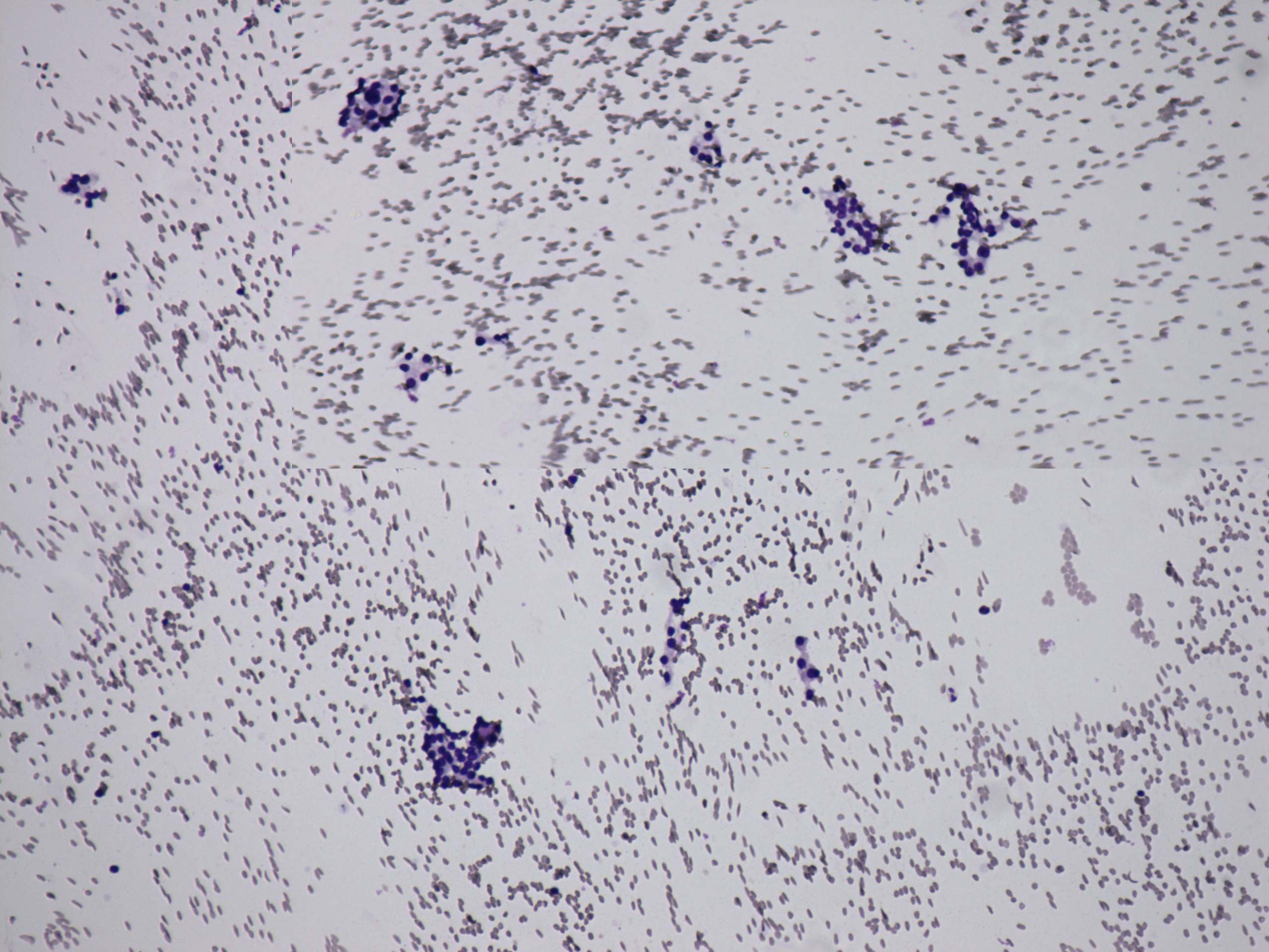 Right lobe, longitudinal scan