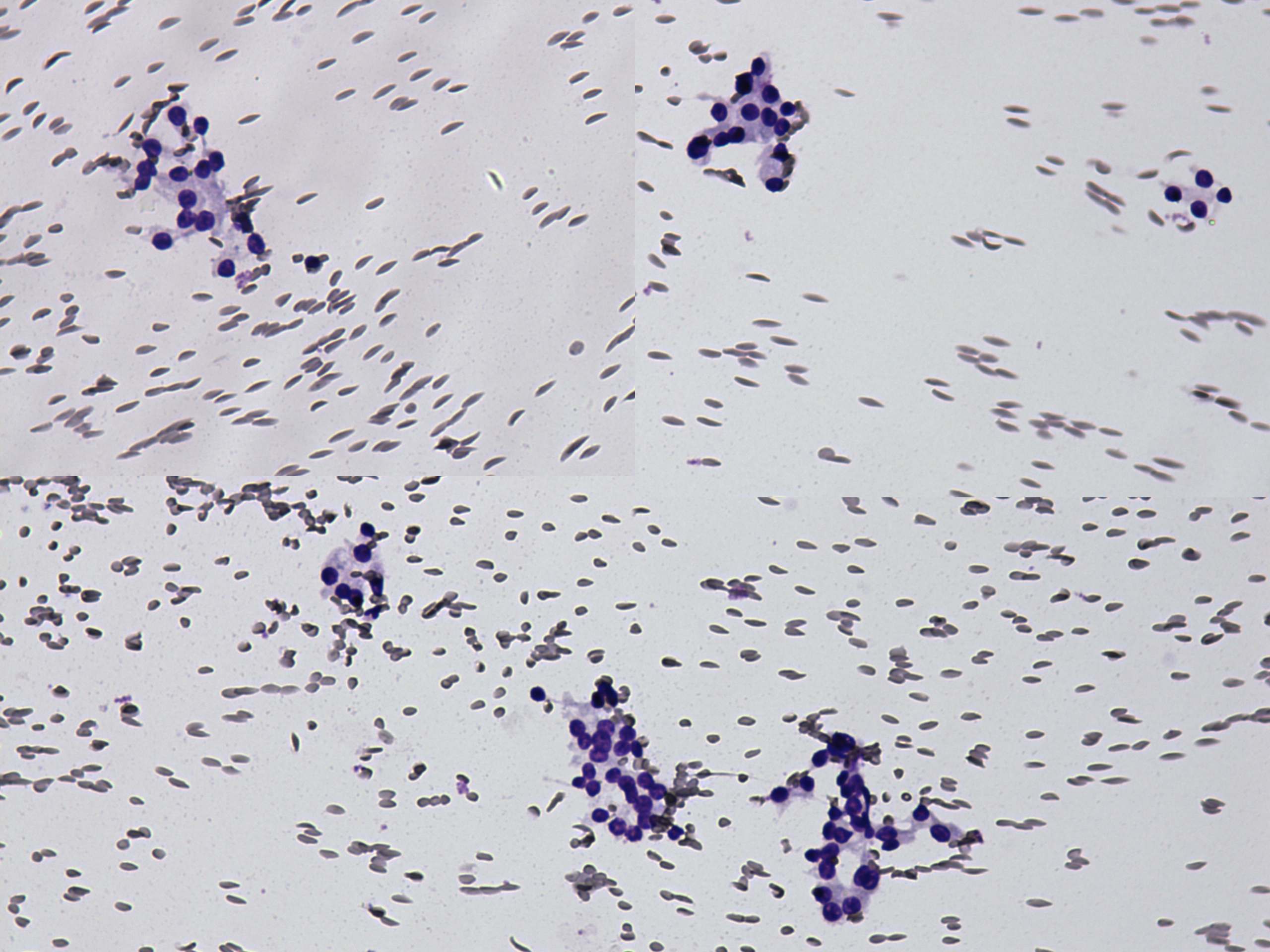 Right lobe, longitudinal scan