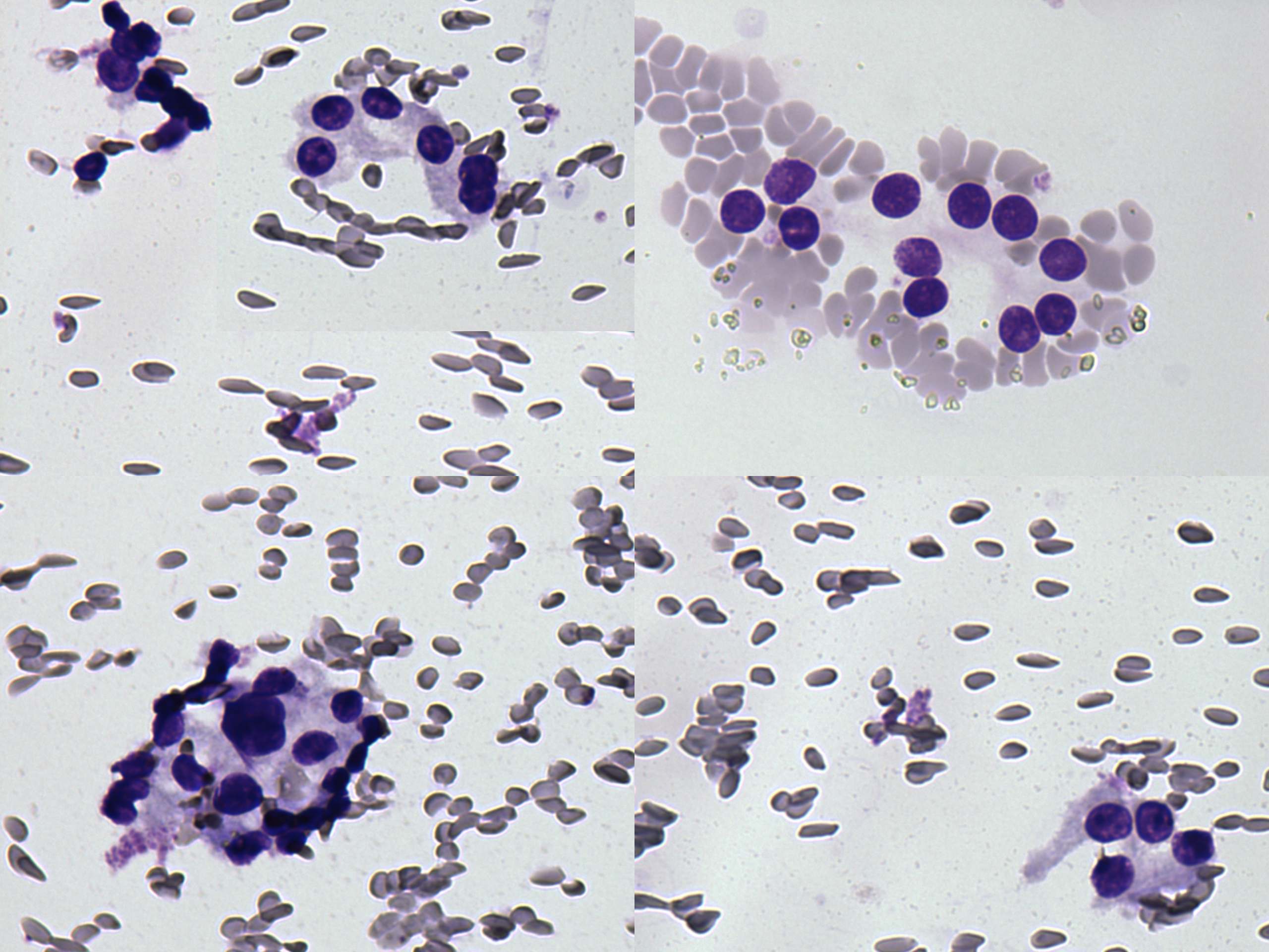 Right lobe, longitudinal scan