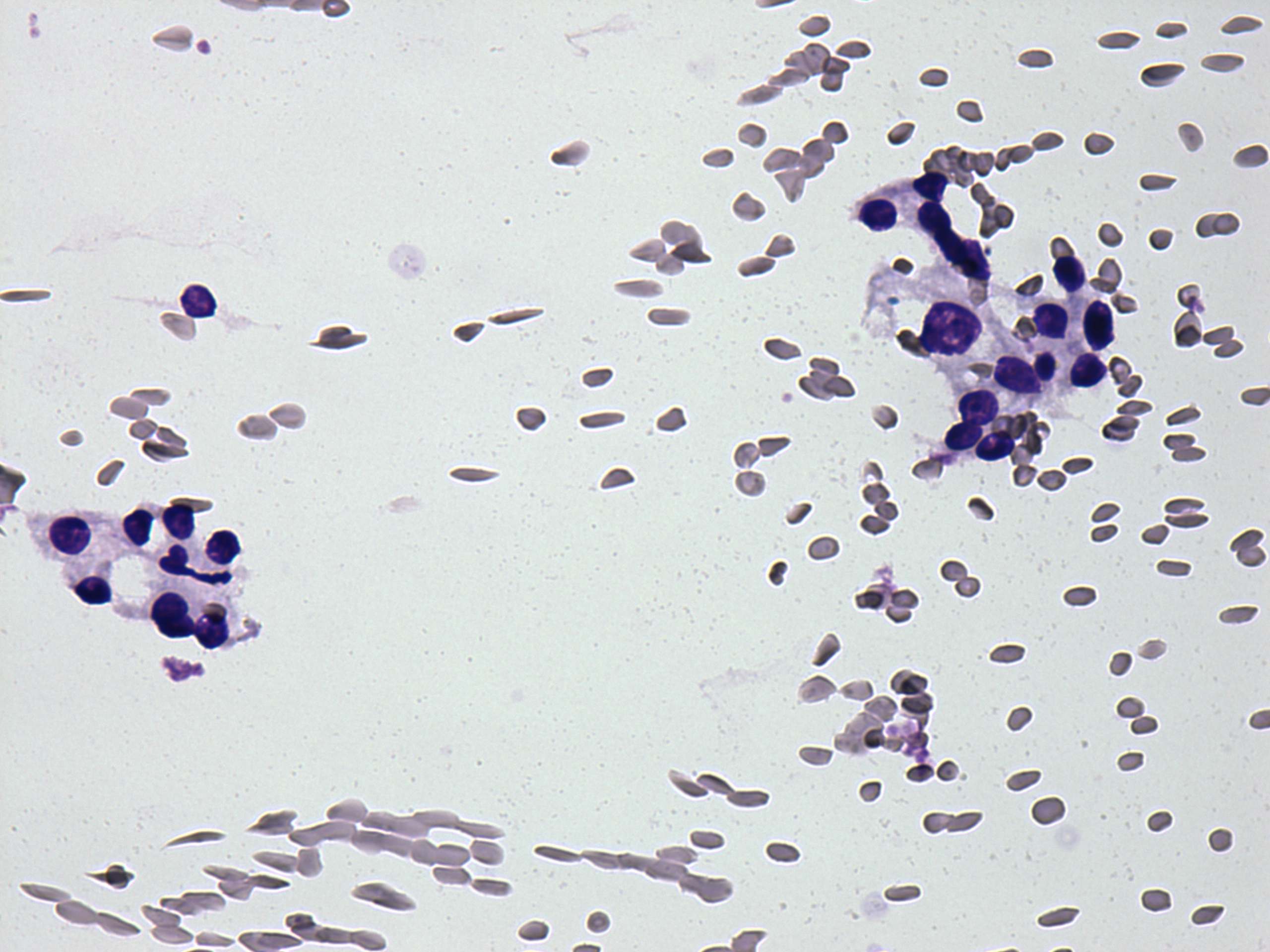 Right lobe, longitudinal scan