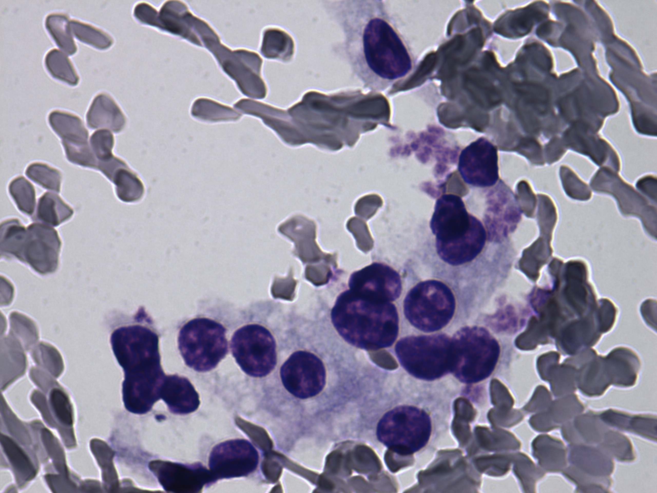 Right lobe, longitudinal scan