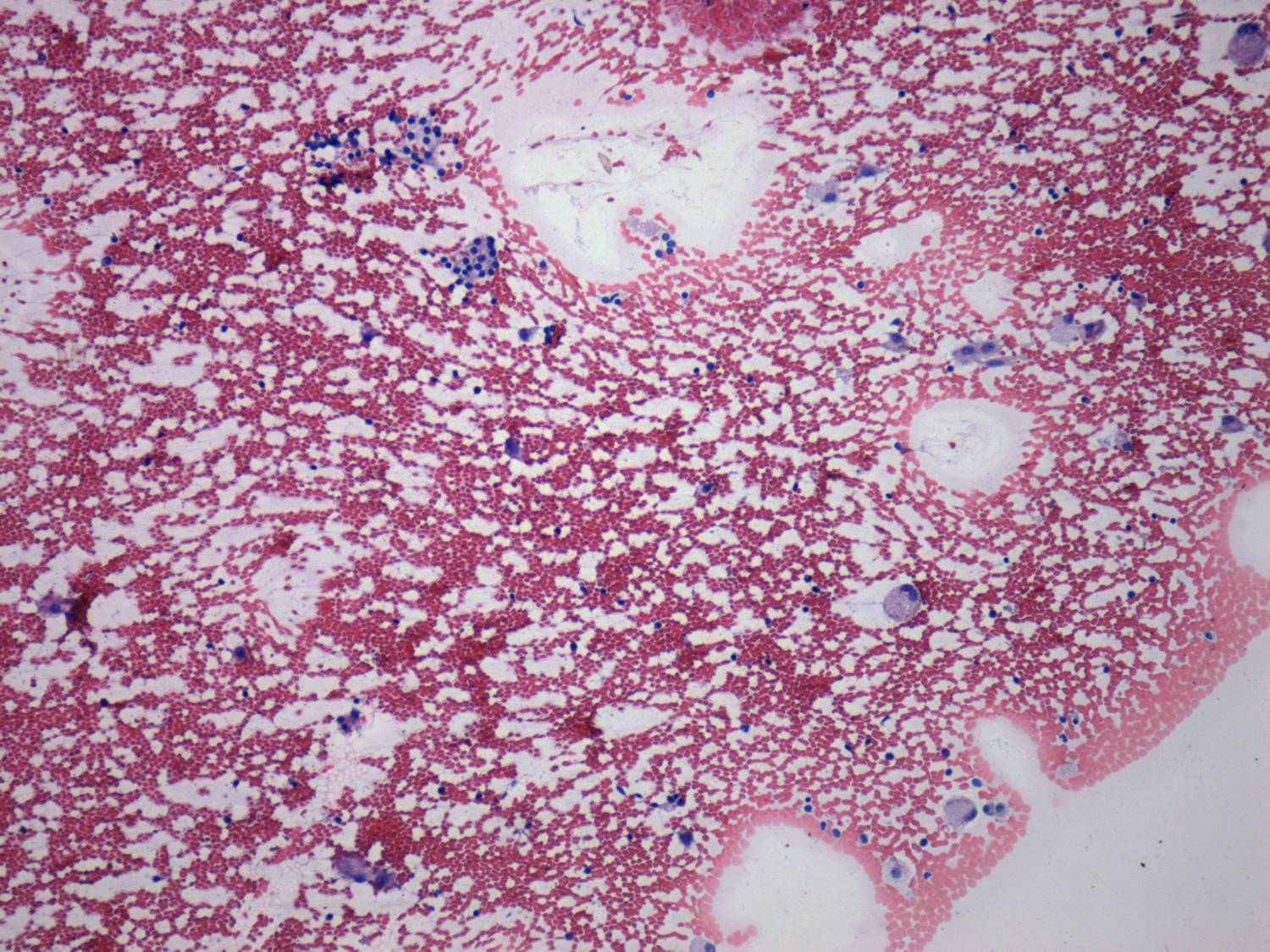 Right lobe, longitudinal scan