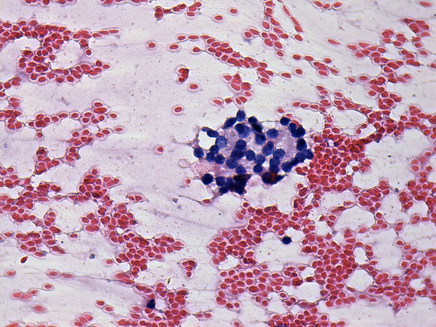 Right lobe, longitudinal scan