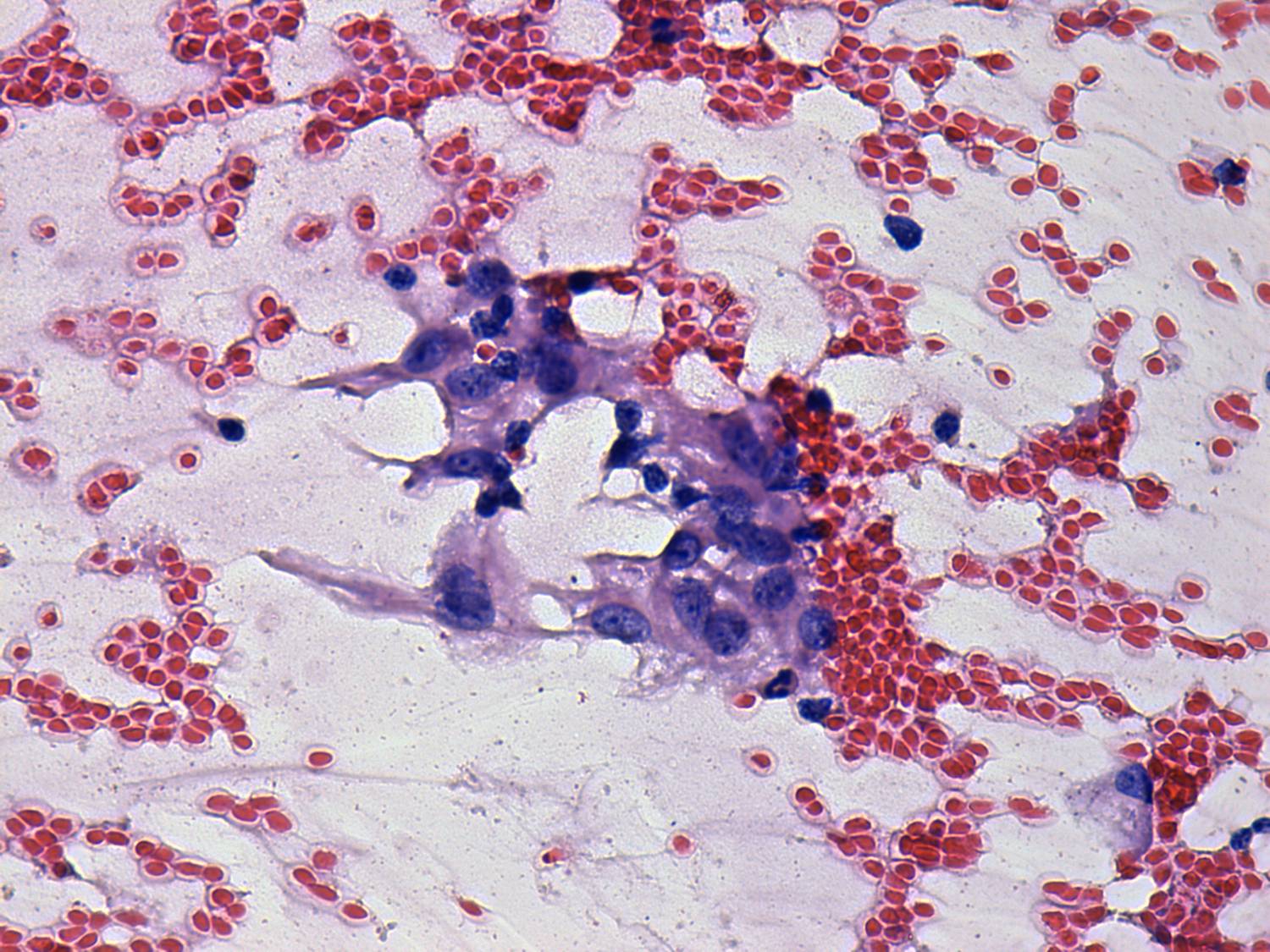 Right lobe, longitudinal scan