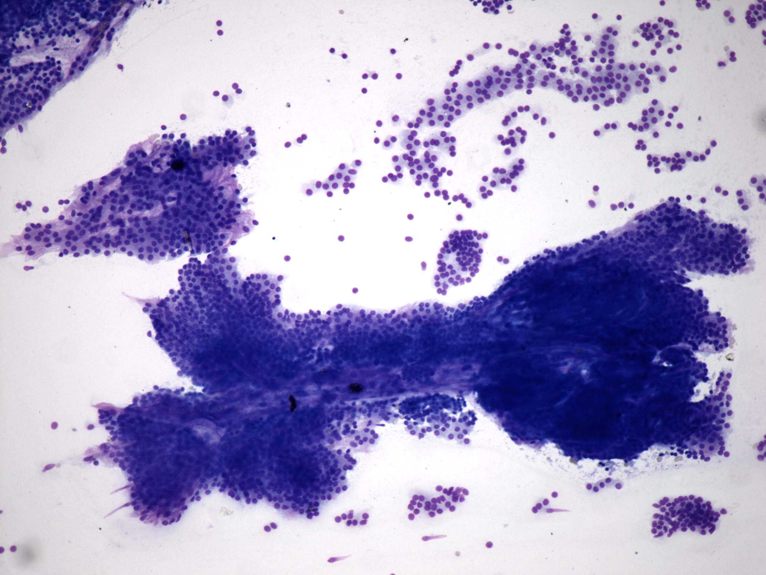 Right lobe, longitudinal scan