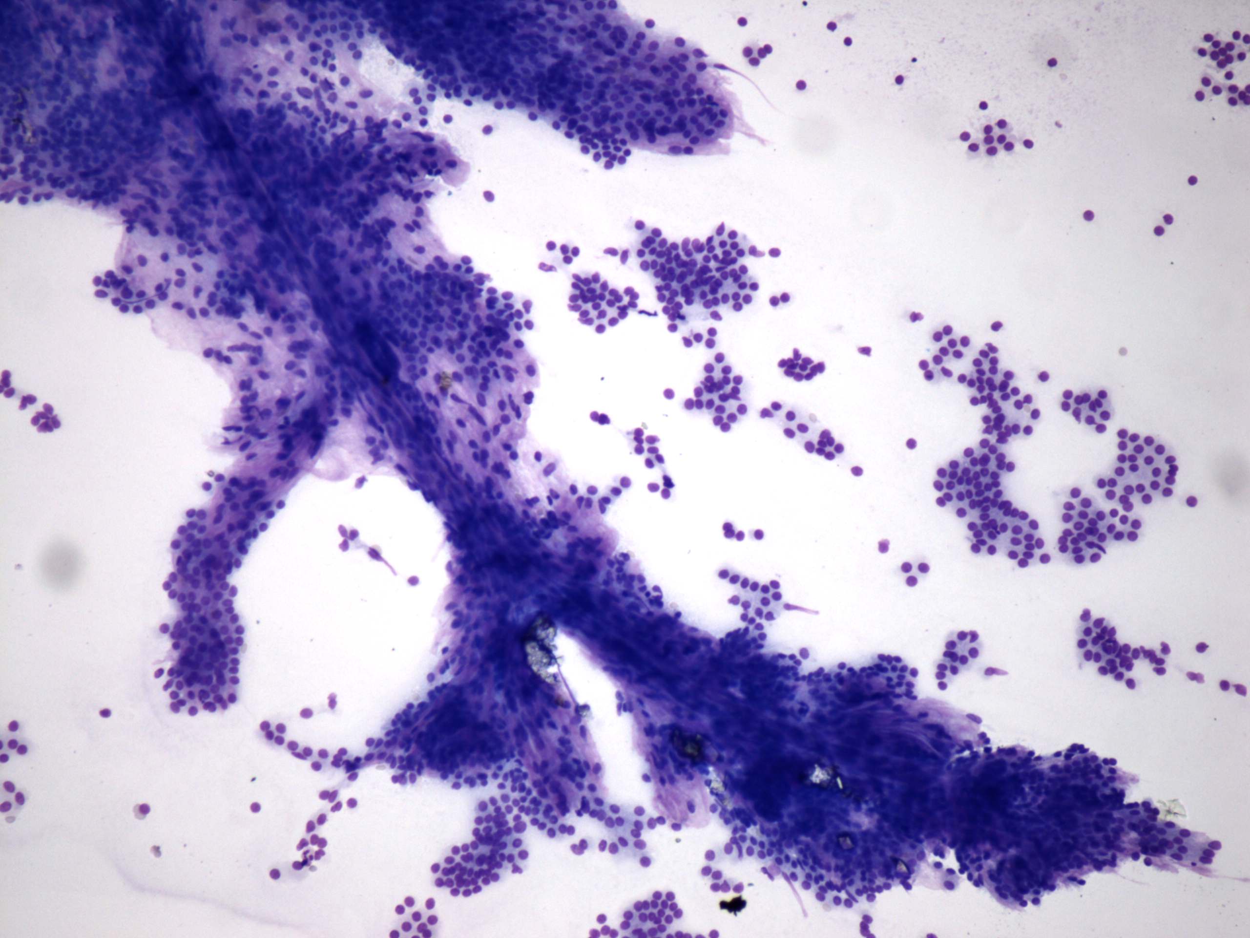 Right lobe, longitudinal scan