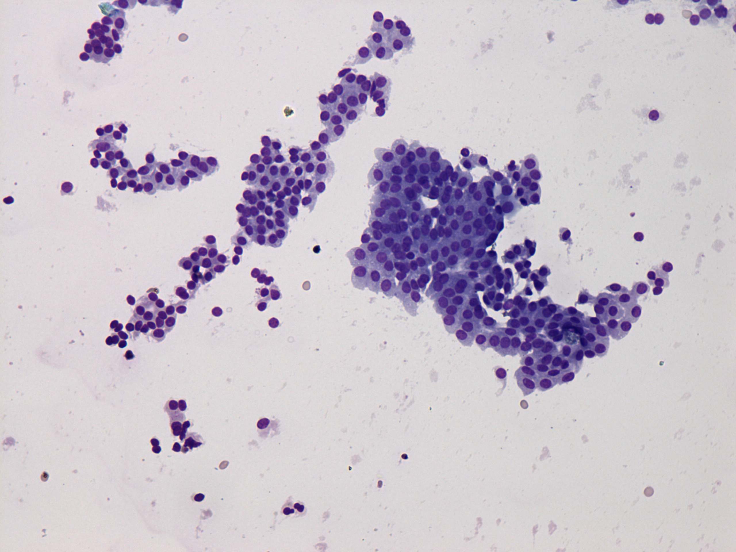 Right lobe, longitudinal scan