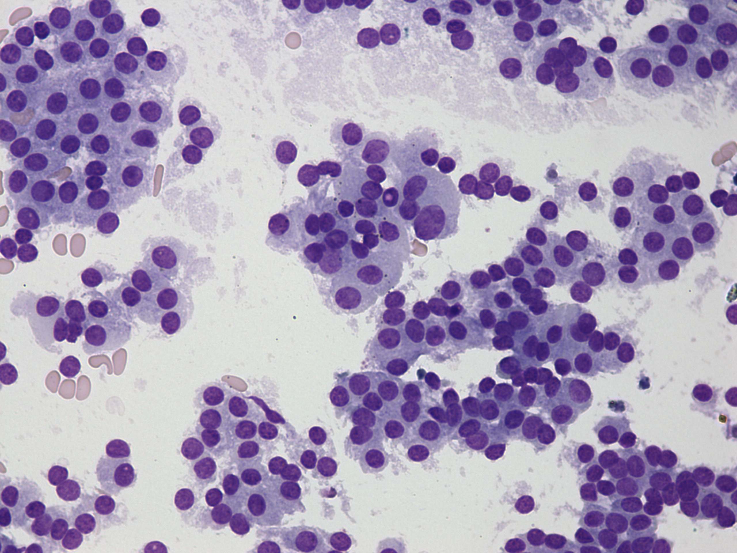 Right lobe, longitudinal scan