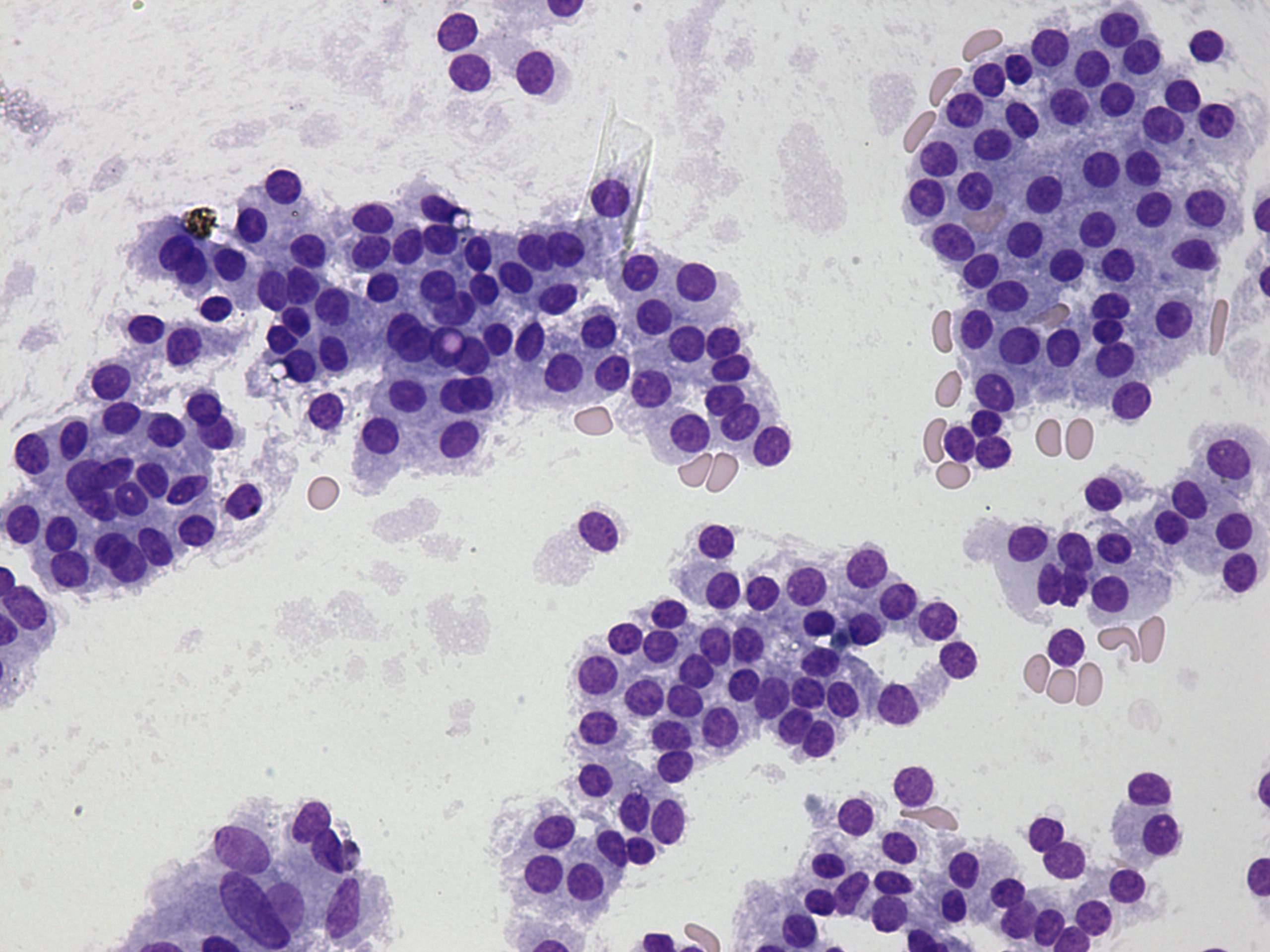 Right lobe, longitudinal scan