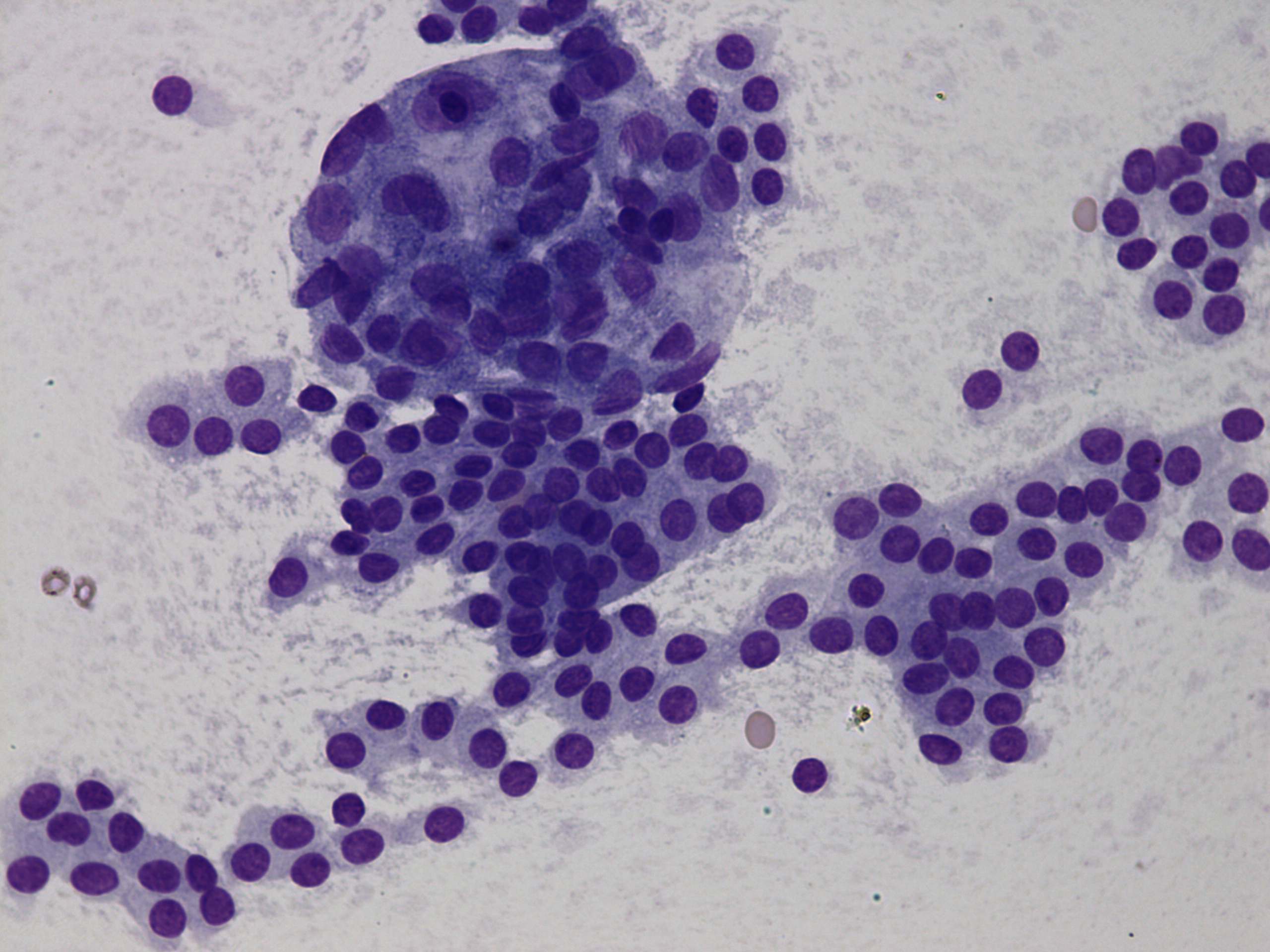 Right lobe, longitudinal scan