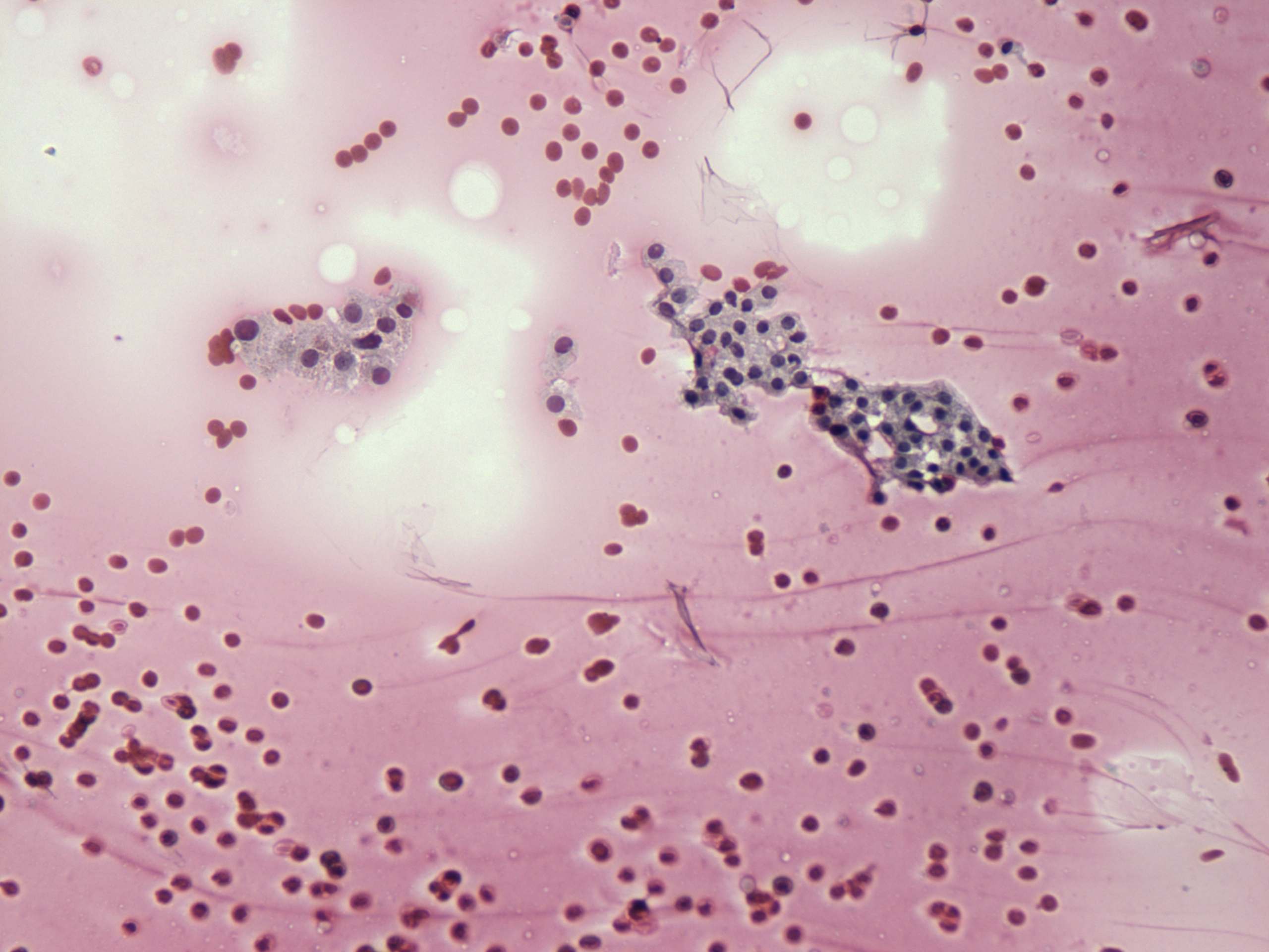 Right lobe, longitudinal scan