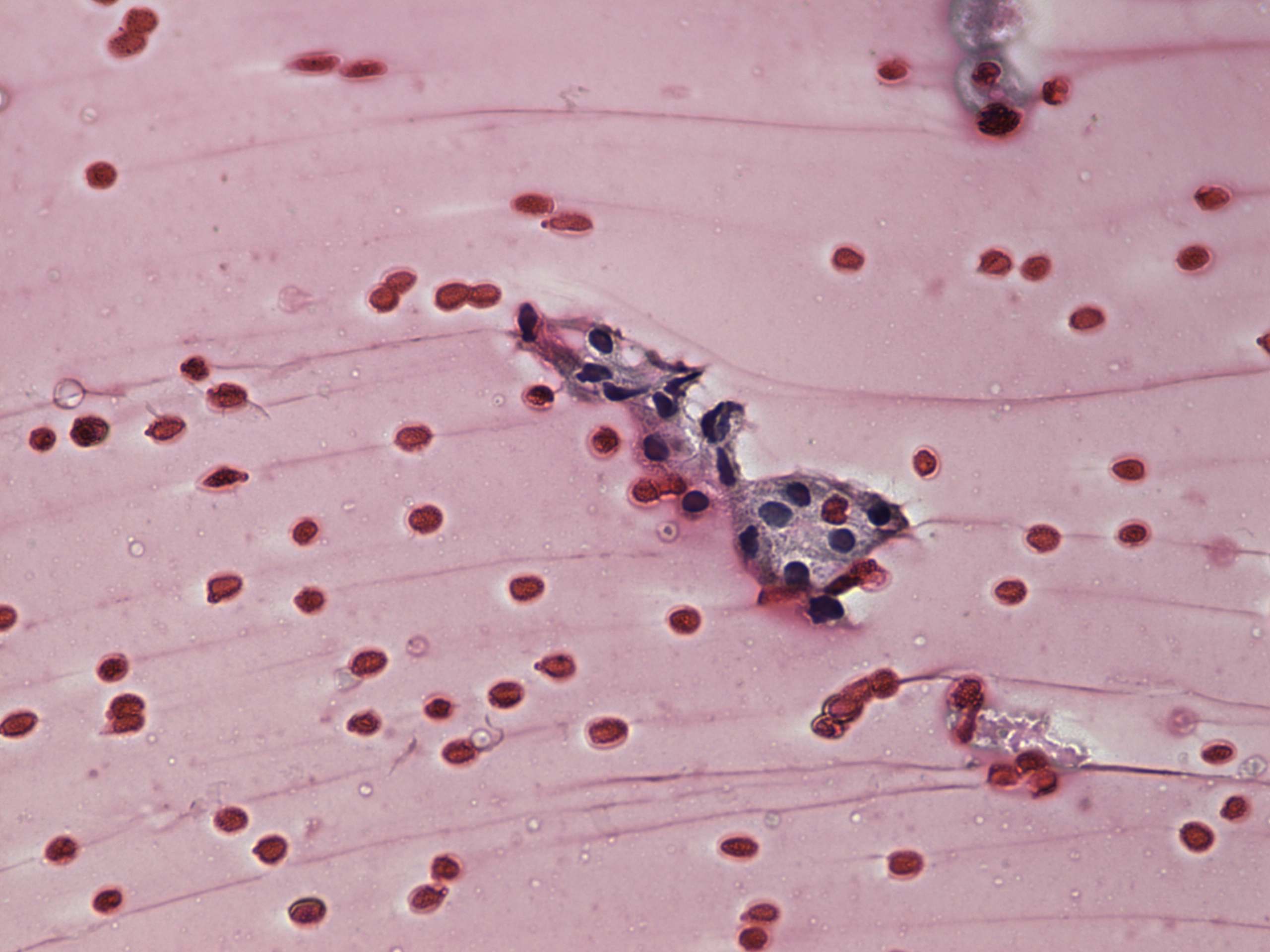 Right lobe, longitudinal scan