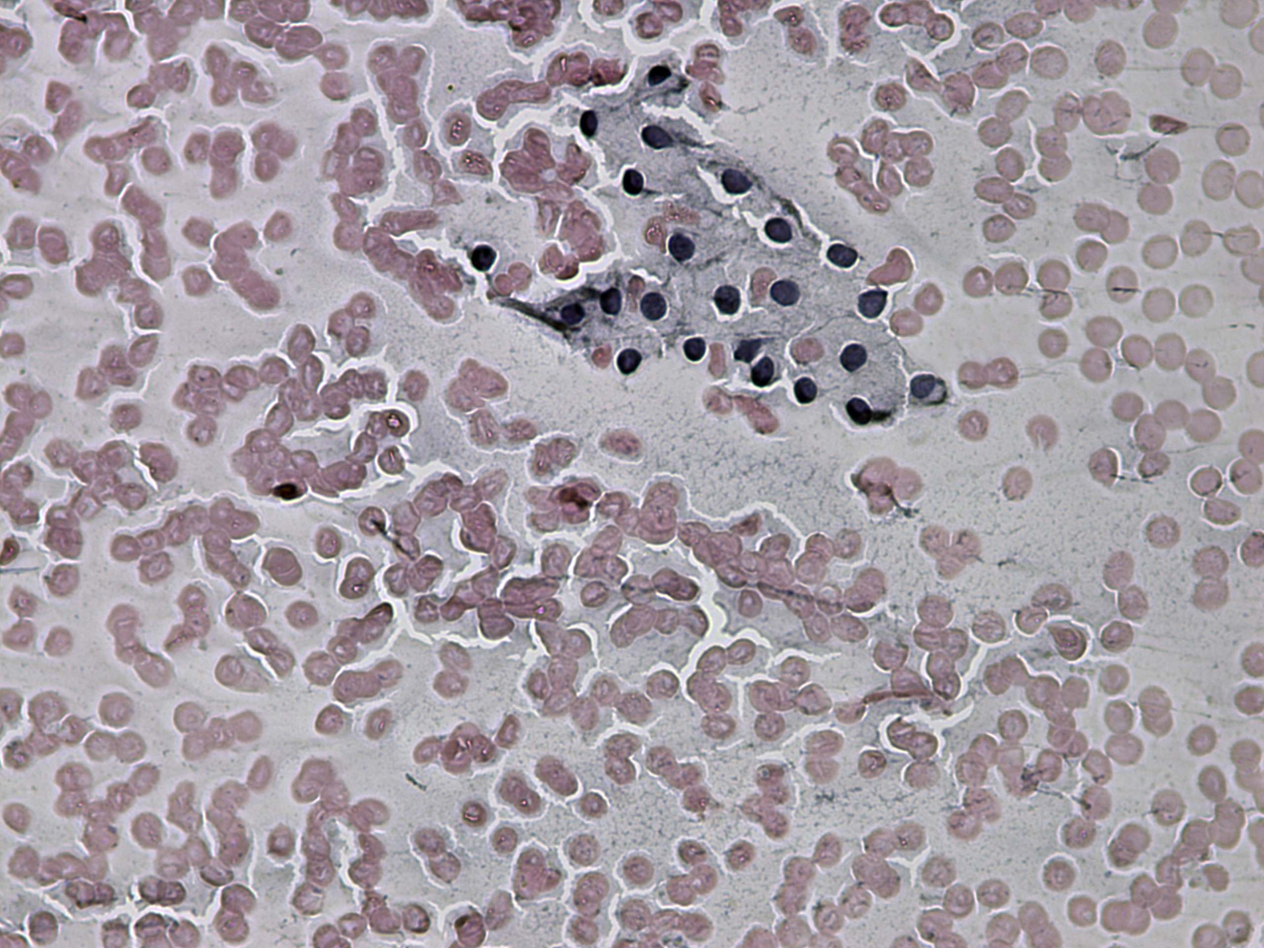 Right lobe, longitudinal scan